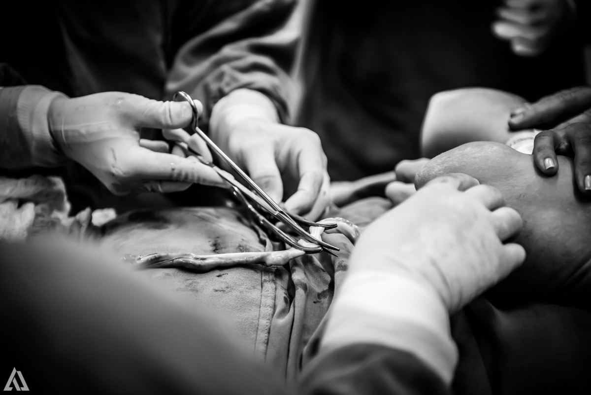 Fotografia de Parto Cesárea Normal Humanizado Alex Jardim Fotografia Fotógrafo iapbp cesarean maternidade Resende Itatiaia Penedo Porto Real Quatis Barra Mansa Volta Redonda Serrinha do Alambari Hospital Maternidade APMIR SAMER UNIMED