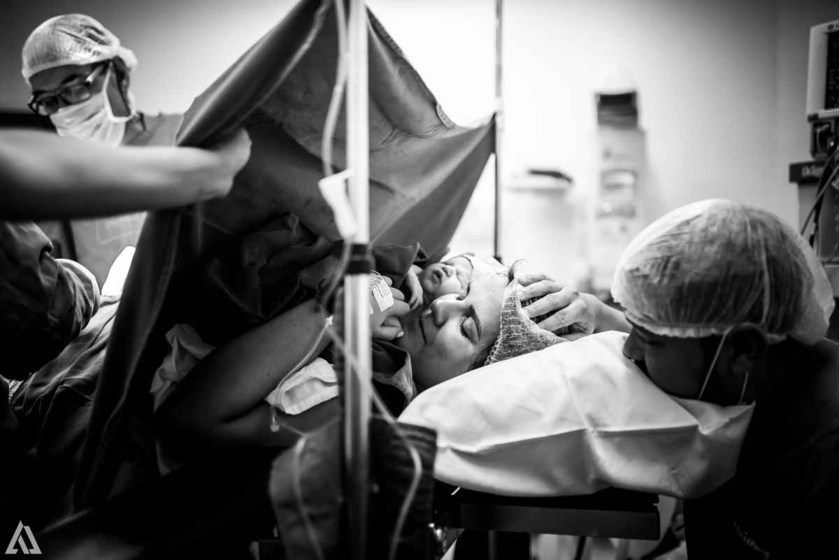 Fotografia de Parto Cesárea Normal Humanizado Alex Jardim Fotografia Fotógrafo iapbp cesarean maternidade Resende Itatiaia Penedo Porto Real Quatis Barra Mansa Volta Redonda Serrinha do Alambari Hospital Maternidade APMIR SAMER UNIMED
