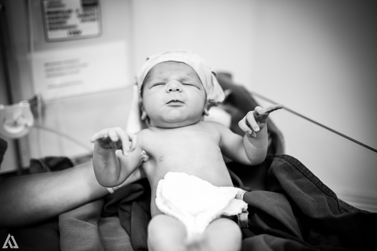 Fotografia de Parto Cesárea Normal Humanizado Alex Jardim Fotografia Fotógrafo iapbp cesarean maternidade Resende Itatiaia Penedo Porto Real Quatis Barra Mansa Volta Redonda Serrinha do Alambari Hospital Maternidade APMIR SAMER UNIMED