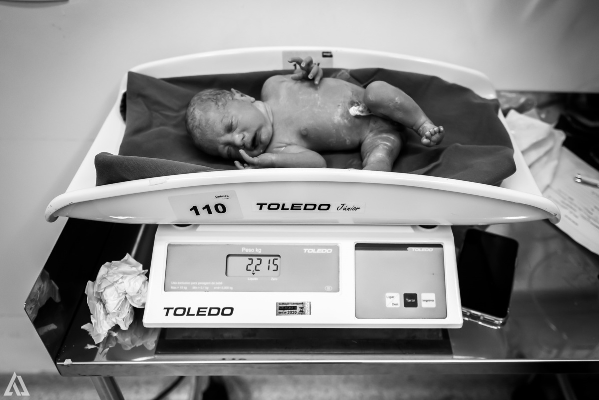 Fotografia de Parto Cesárea Normal Humanizado Alex Jardim Fotografia Fotógrafo iapbp cesarean maternidade Resende Itatiaia Penedo Porto Real Quatis Barra Mansa Volta Redonda Serrinha do Alambari Hospital Maternidade APMIR SAMER UNIMED