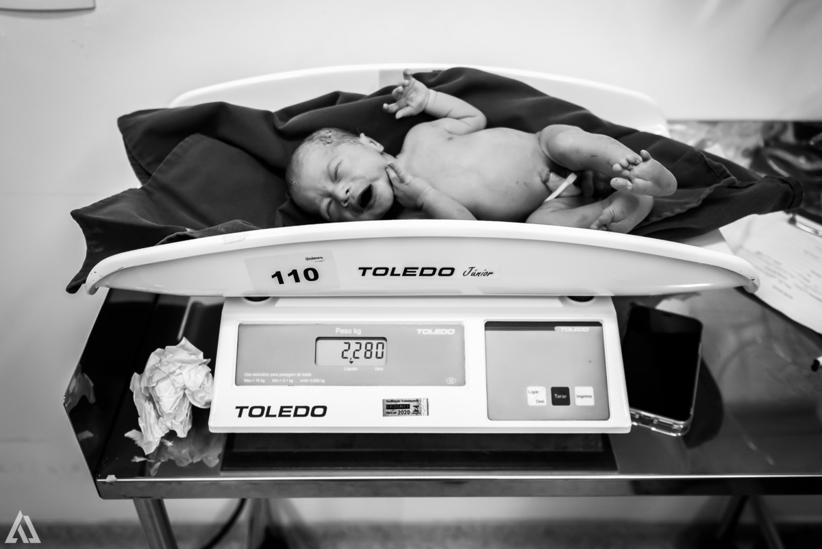 Fotografia de Parto Cesárea Normal Humanizado Alex Jardim Fotografia Fotógrafo iapbp cesarean maternidade Resende Itatiaia Penedo Porto Real Quatis Barra Mansa Volta Redonda Serrinha do Alambari Hospital Maternidade APMIR SAMER UNIMED