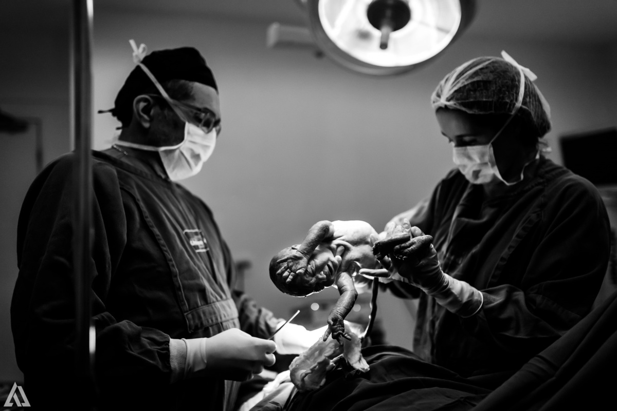 Fotografia de Parto Cesárea Normal Humanizado Alex Jardim Fotografia Fotógrafo iapbp cesarean maternidade Resende Itatiaia Penedo Porto Real Quatis Barra Mansa Volta Redonda Serrinha do Alambari Hospital Maternidade APMIR SAMER UNIMED