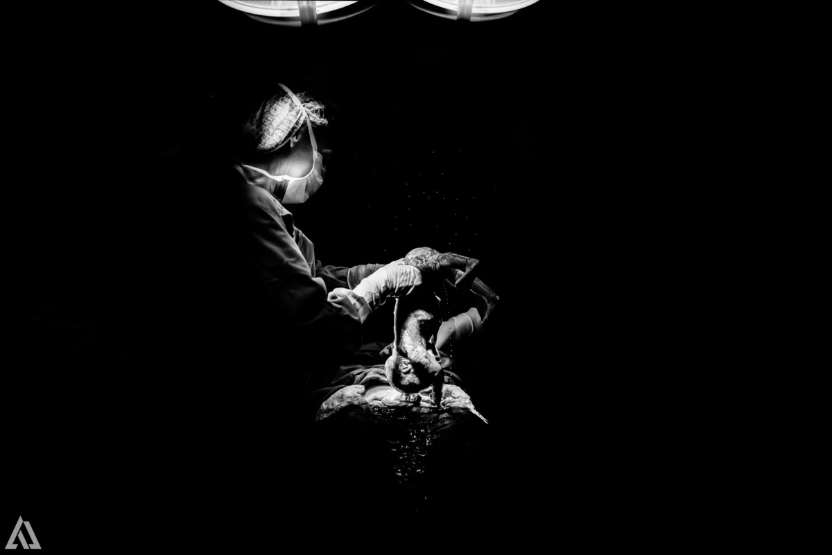 Fotografia de Parto Cesárea Normal Humanizado Alex Jardim Fotografia Fotógrafo iapbp cesarean maternidade Resende Itatiaia Penedo Porto Real Quatis Barra Mansa Volta Redonda Serrinha do Alambari Hospital Maternidade APMIR SAMER UNIMED