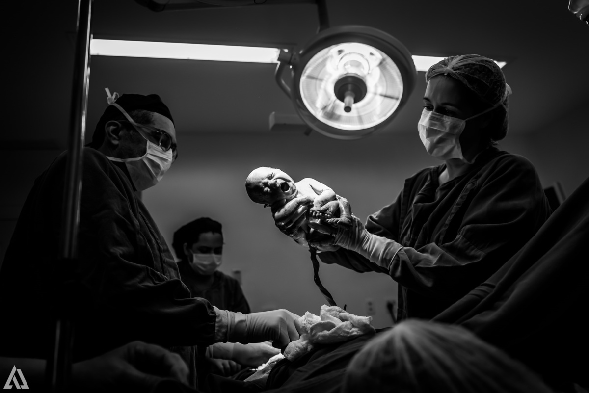 Fotografia de Parto Cesárea Normal Humanizado Alex Jardim Fotografia Fotógrafo iapbp cesarean maternidade Resende Itatiaia Penedo Porto Real Quatis Barra Mansa Volta Redonda Serrinha do Alambari Hospital Maternidade APMIR SAMER UNIMED