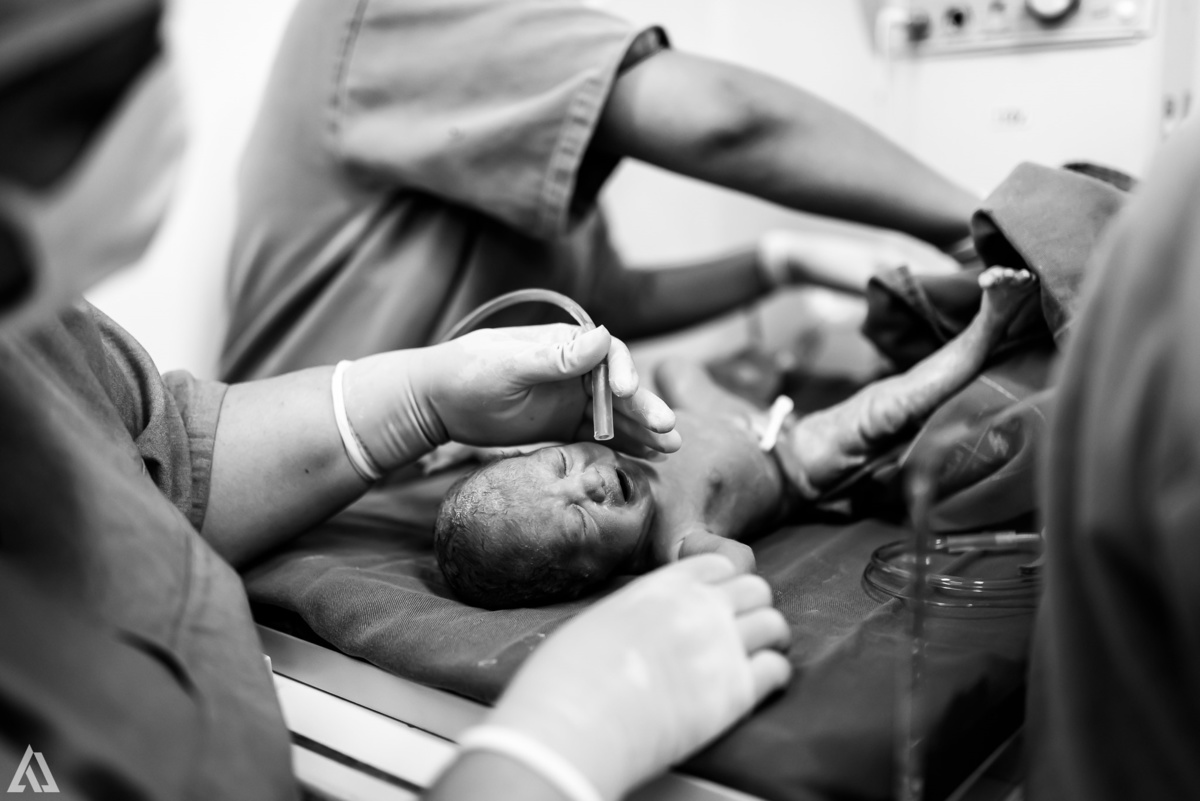 Fotografia de Parto Cesárea Normal Humanizado Alex Jardim Fotografia Fotógrafo iapbp cesarean maternidade Resende Itatiaia Penedo Porto Real Quatis Barra Mansa Volta Redonda Serrinha do Alambari Hospital Maternidade APMIR SAMER UNIMED