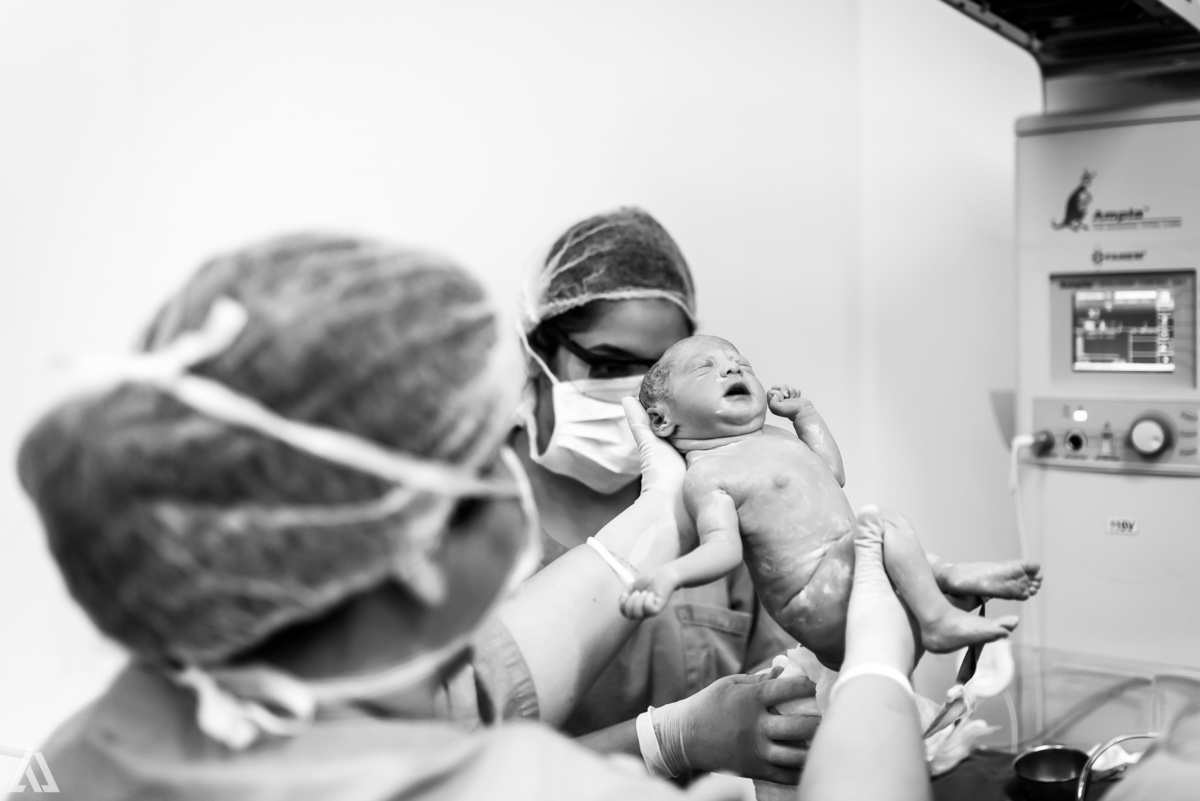 Fotografia de Parto Cesárea Normal Humanizado Alex Jardim Fotografia Fotógrafo iapbp cesarean maternidade Resende Itatiaia Penedo Porto Real Quatis Barra Mansa Volta Redonda Serrinha do Alambari Hospital Maternidade APMIR SAMER UNIMED