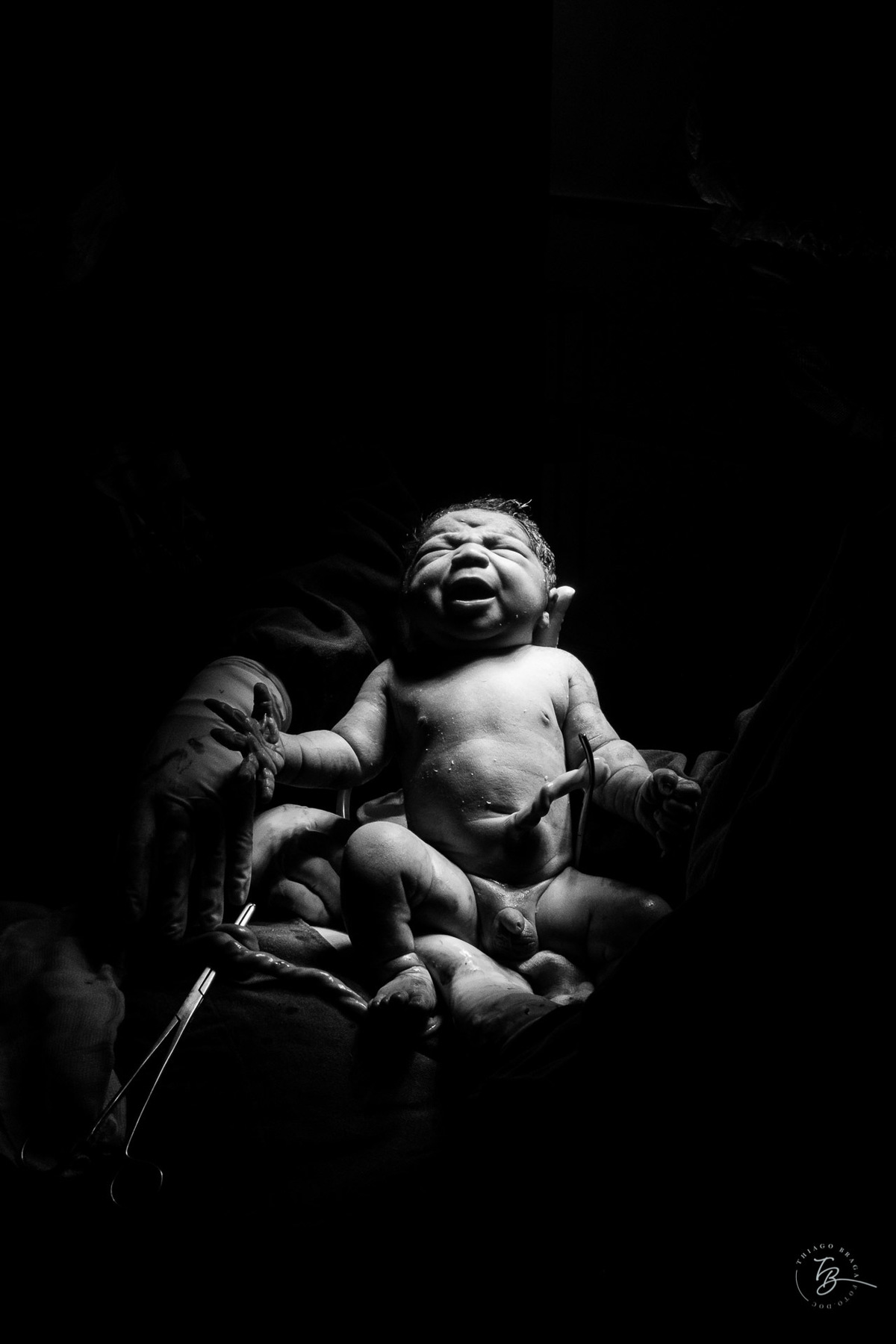 Fotografia de nascimento na maternidade ilha por Thiago Braga