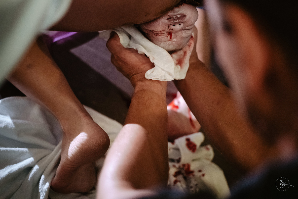 fotografia de nascimento, parto natural, normal, na maternidade santa helena em florianopolis-sc por Thiago Braga