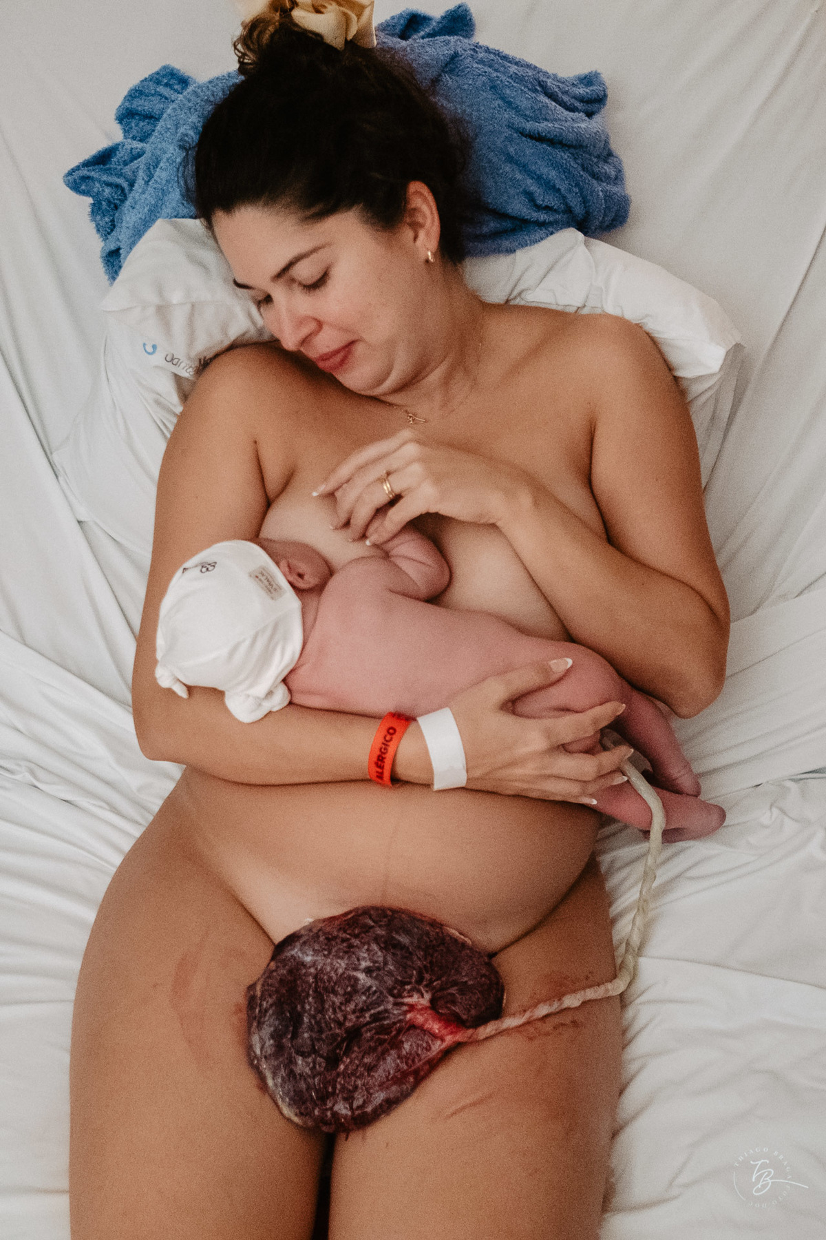 Fotografia de parto natural na maternidade Santa Helena em Florianópolis por Thiago Braga Fotografia