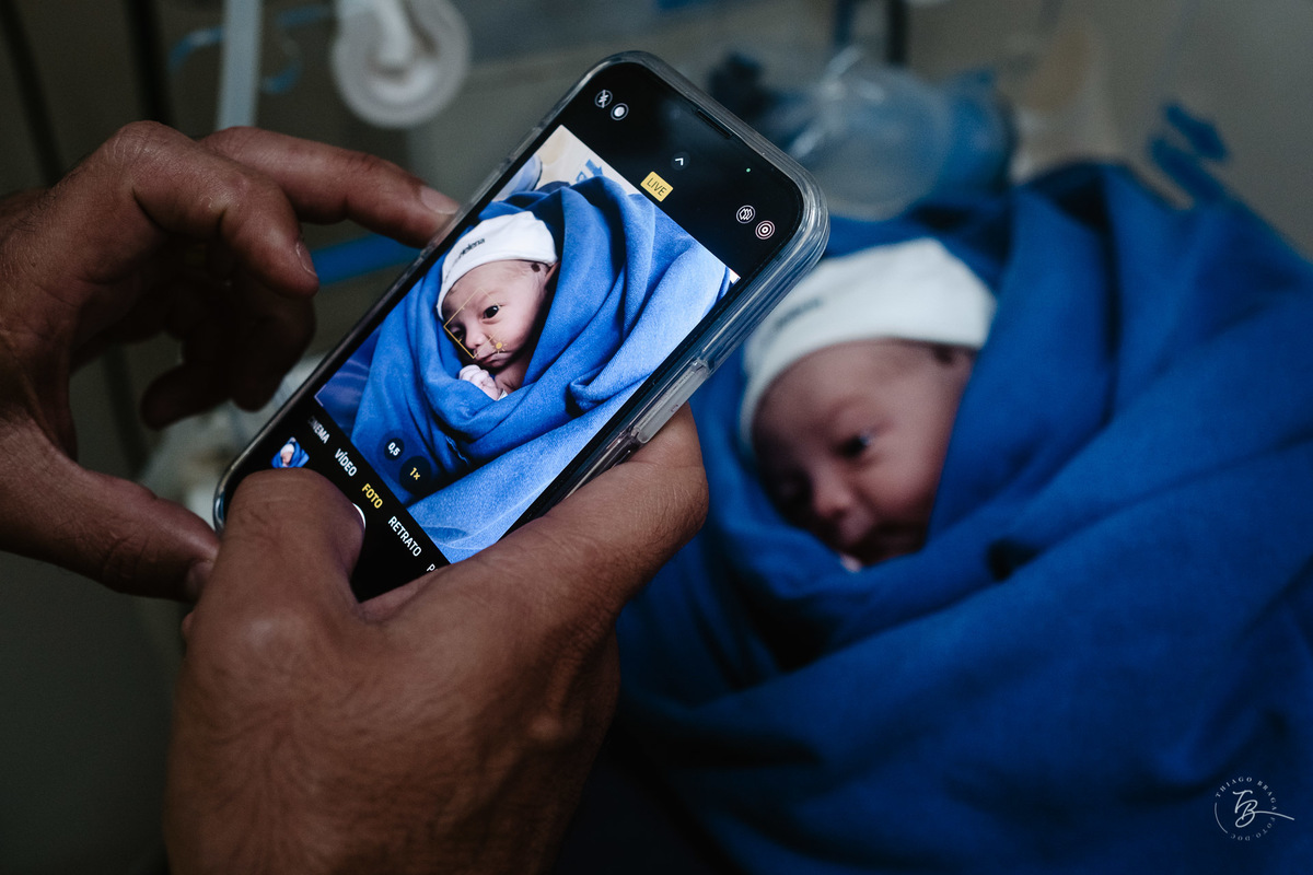 Fotografia de nascimento, na maternidade santa helena em florianópolis, parto cesárea por Thiago Braga
