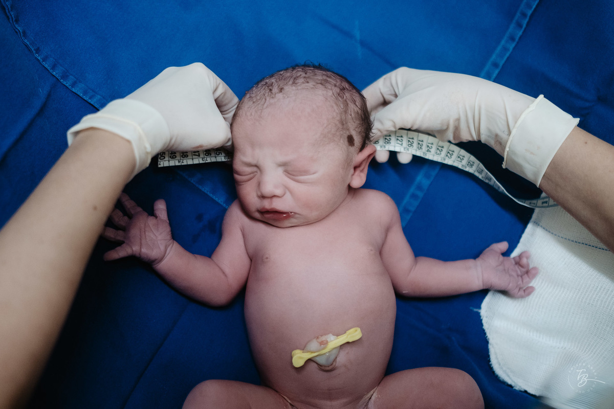 Fotografia de nascimento, na maternidade santa helena em florianópolis, parto cesárea por Thiago Braga