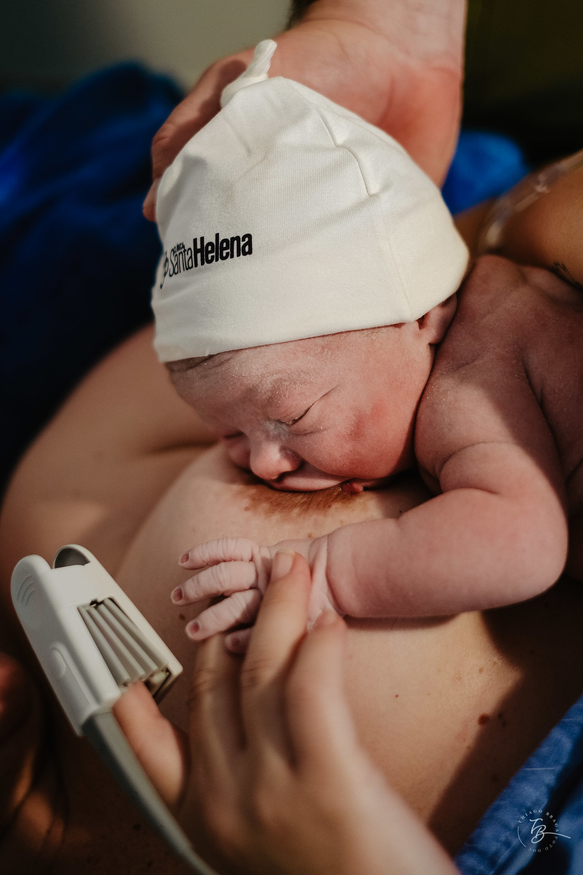 Fotografia de Parto cesárea na maternidade Santa Helena, em Florianópolis - SC