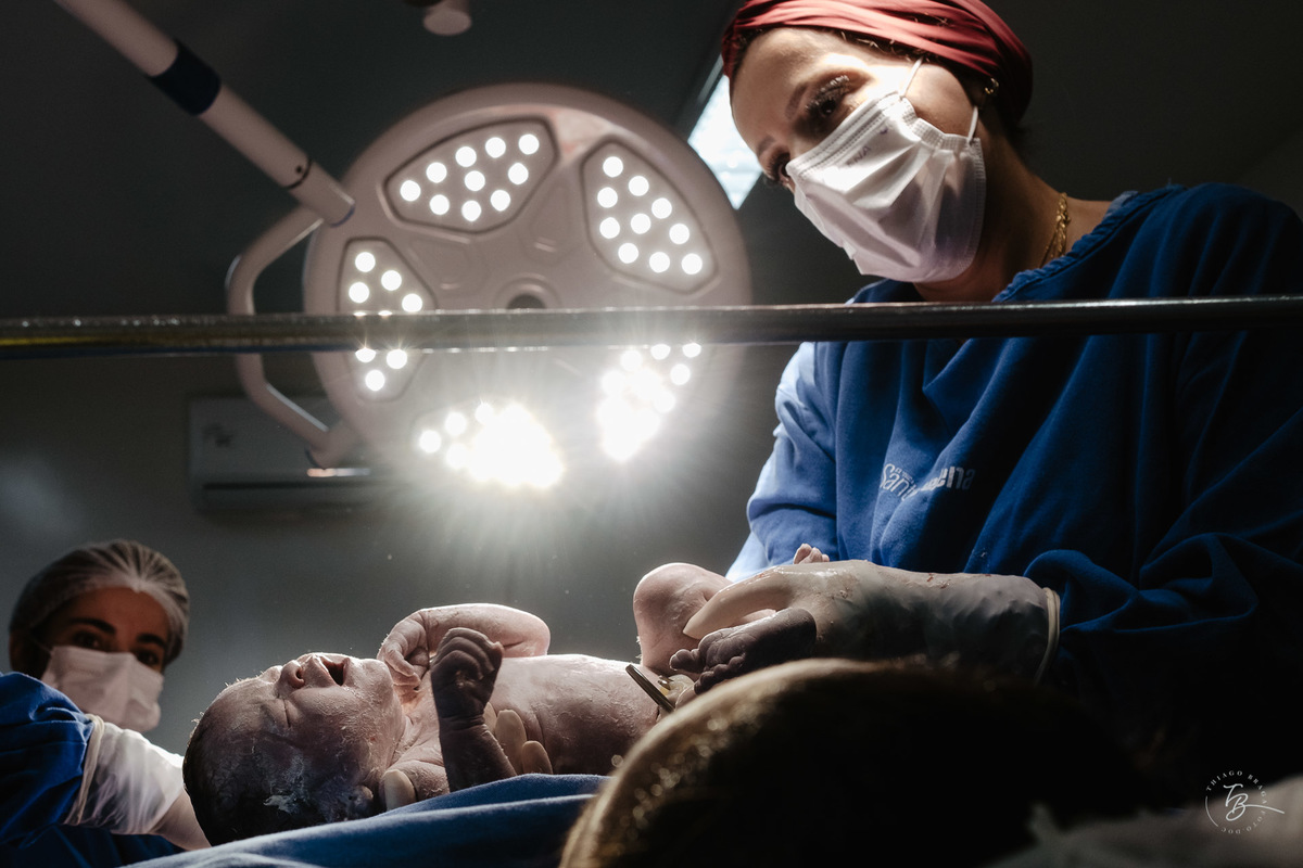 fotografia de parto humanizado na clínica Santa Helena em Florianópolis, cesárea, por Thiago Braga