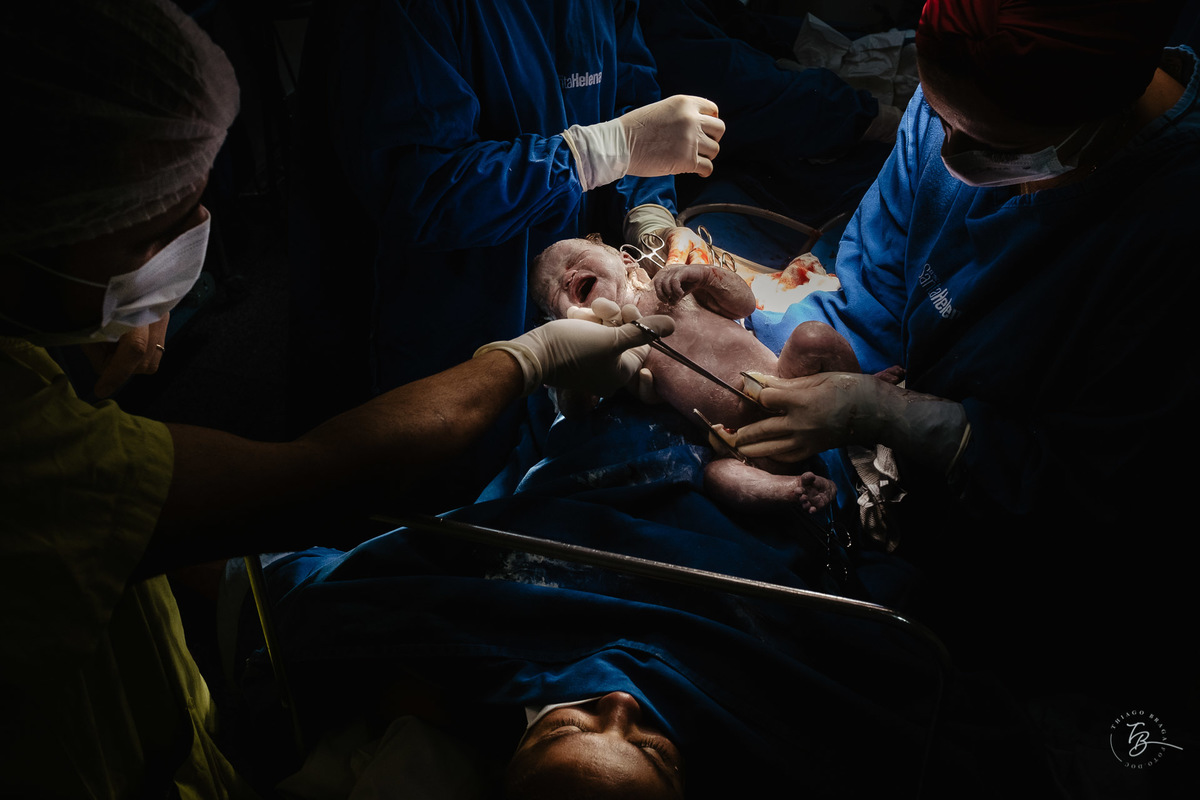 fotografia de parto humanizado na clínica Santa Helena em Florianópolis, cesárea, por Thiago Braga