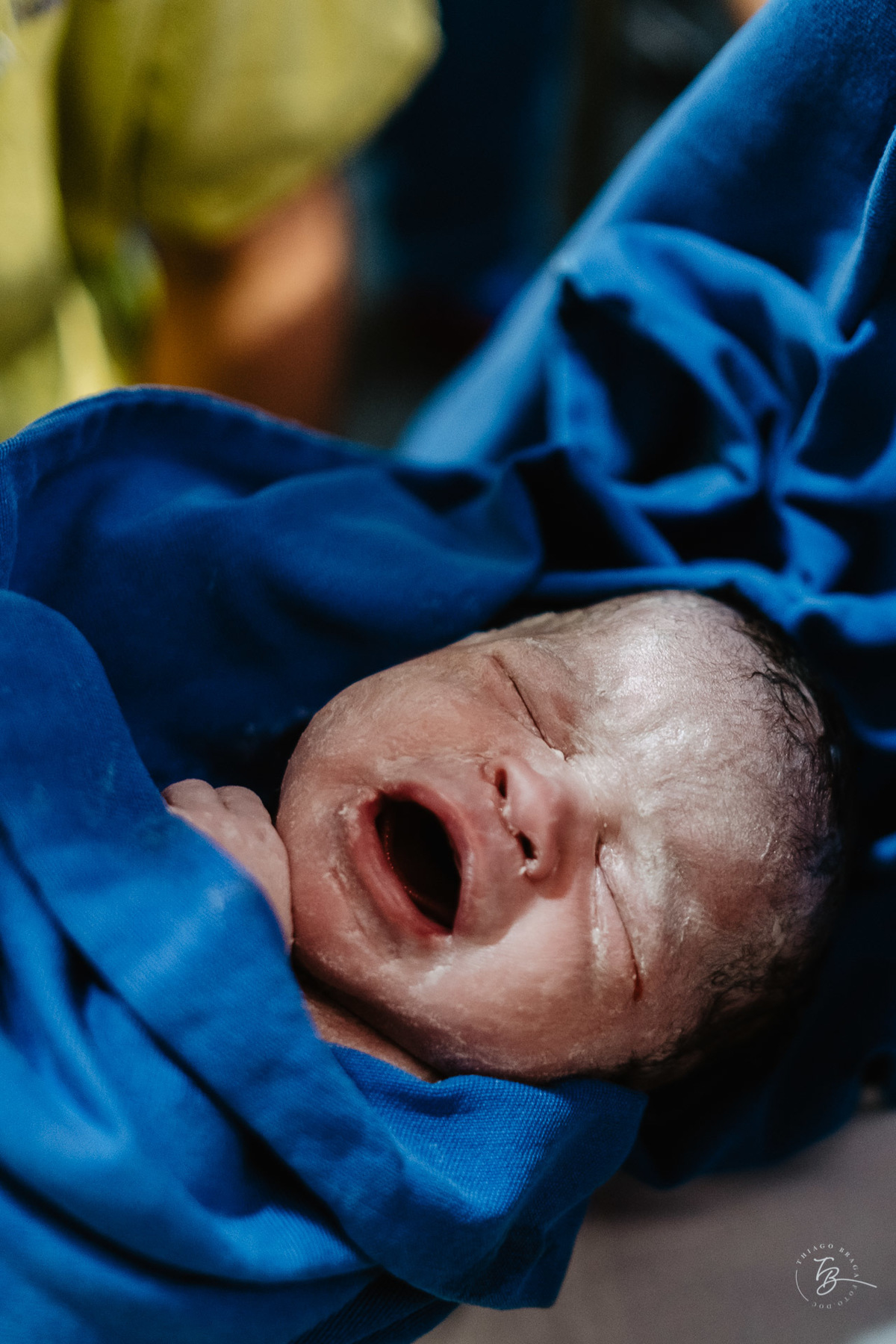 fotografia de parto humanizado na clínica Santa Helena em Florianópolis, cesárea, por Thiago Braga