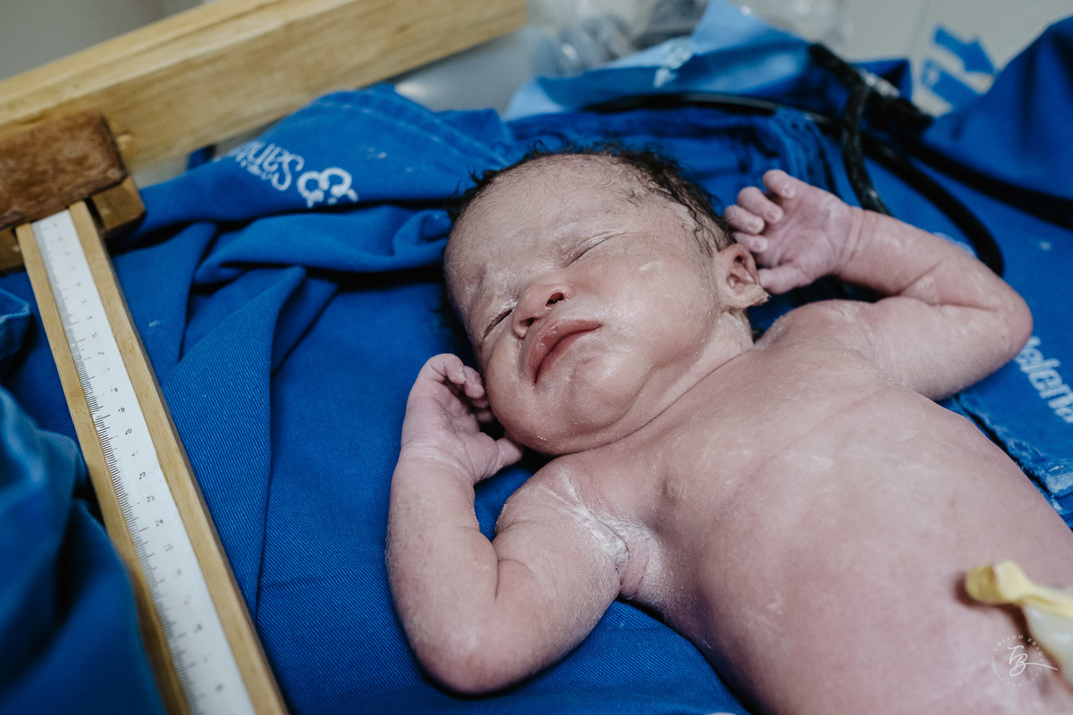 fotografia de parto humanizado na clínica Santa Helena em Florianópolis, cesárea, por Thiago Braga