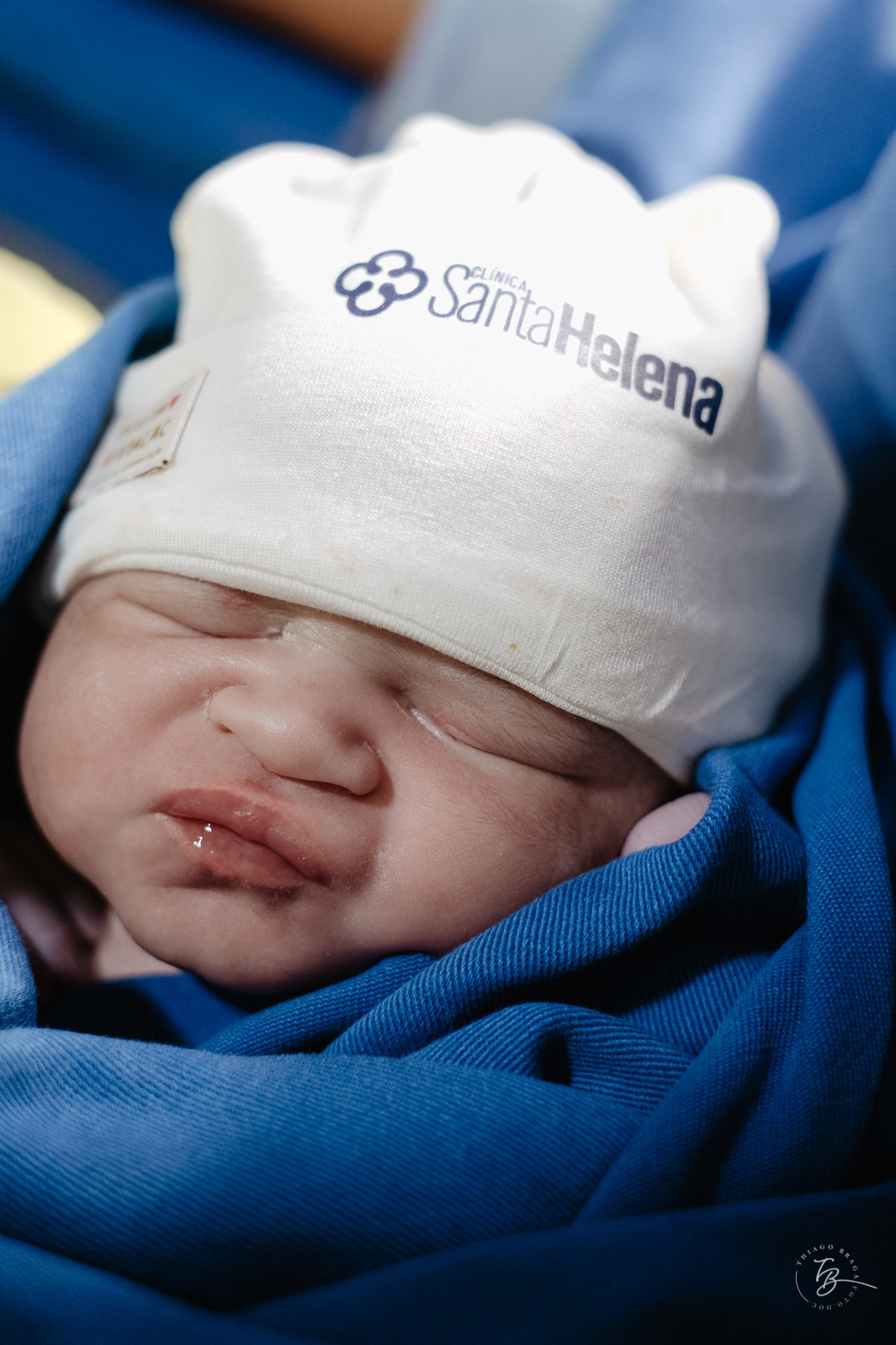 fotografia de parto humanizado na clínica Santa Helena em Florianópolis, cesárea, por Thiago Braga