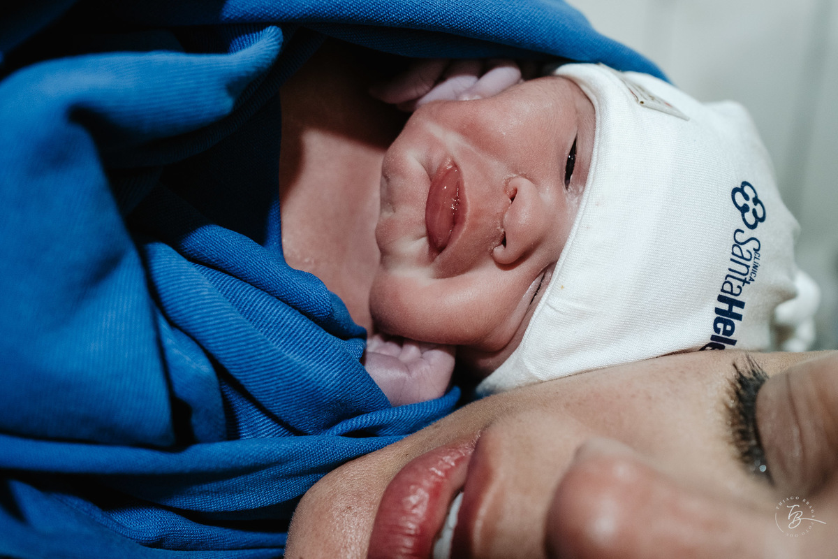 fotografia de parto humanizado na clínica Santa Helena em Florianópolis, cesárea, por Thiago Braga