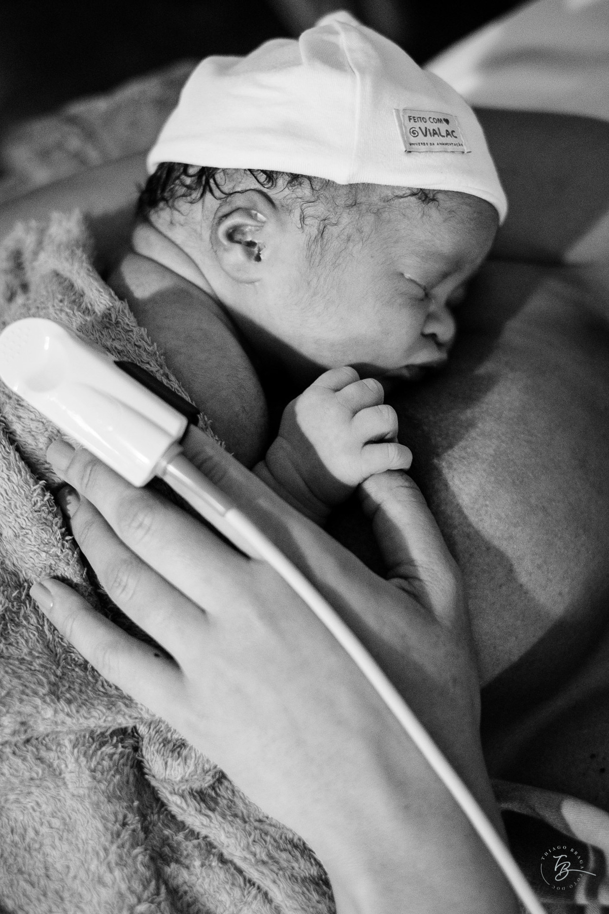 fotografia de parto humanizado na clínica Santa Helena em Florianópolis, cesárea, por Thiago Braga