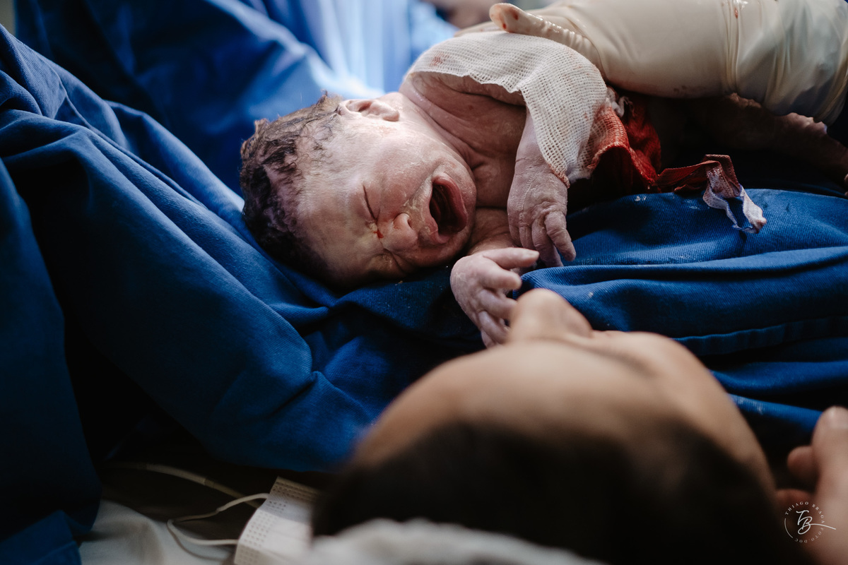 cesárea humanizada, parto na maternidade santa helena em Florianópolis por Thiago Braga fotografia