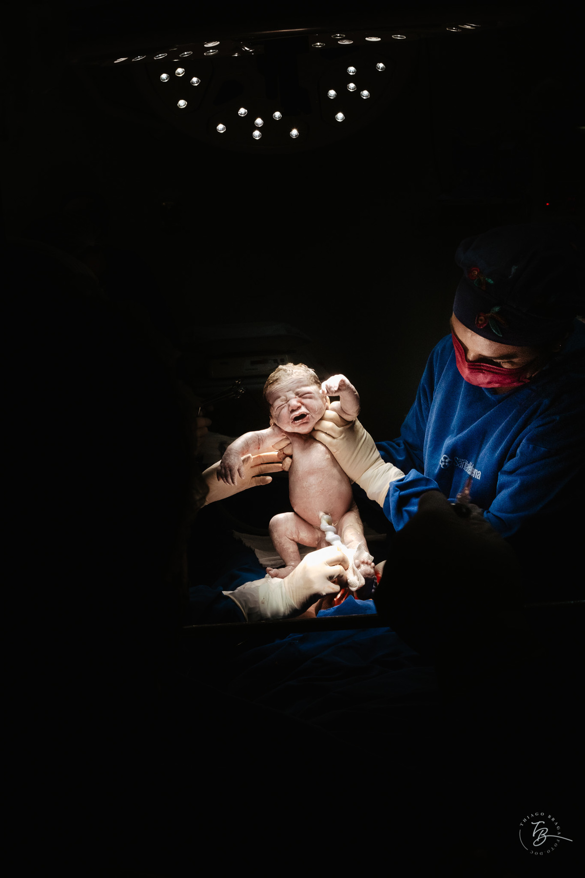 cesárea humanizada, parto na maternidade santa helena em Florianópolis por Thiago Braga fotografia