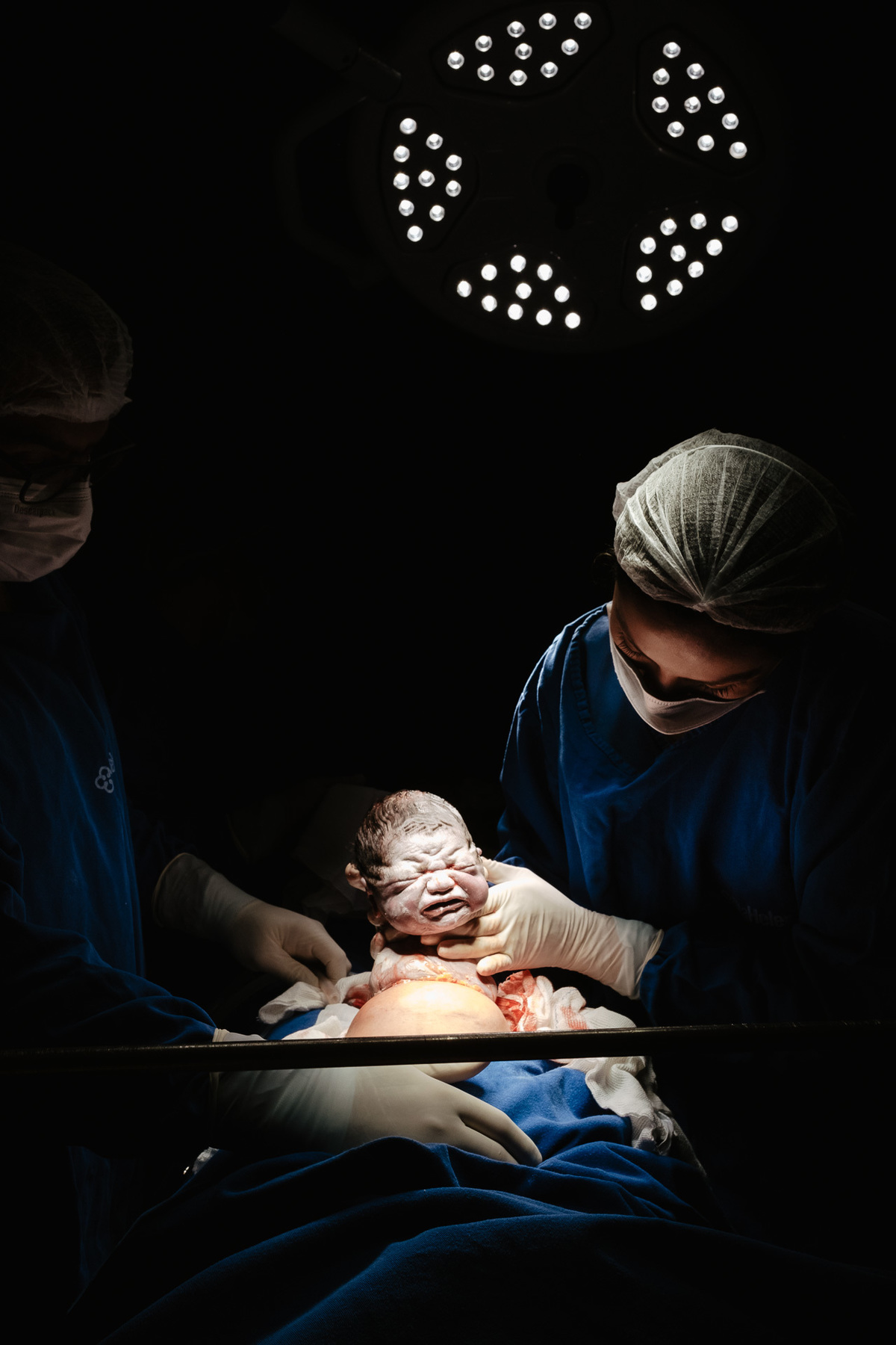 fotografia de nascimento, parto cesárea na maternidade santa helena em Florianópolis por Thiago Braga