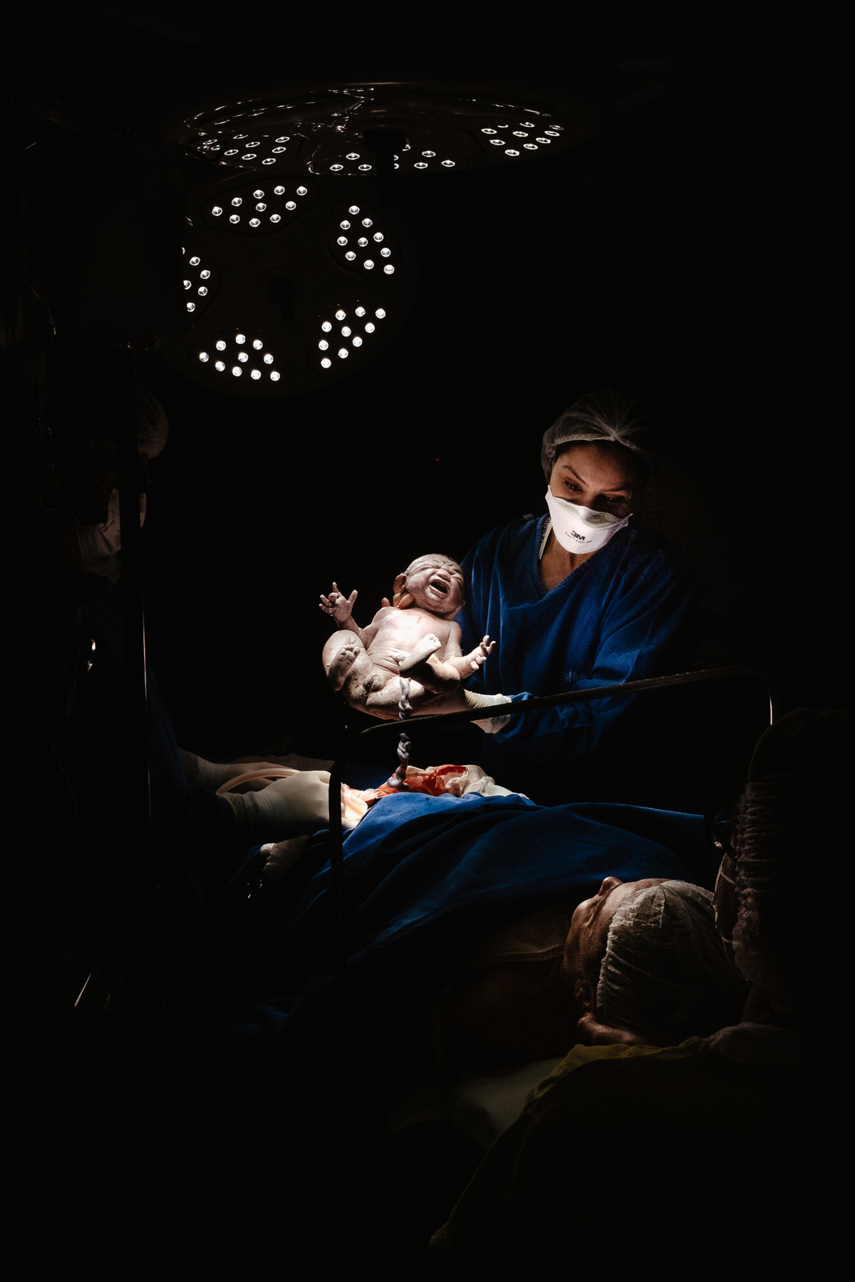 fotografia de nascimento, parto cesárea na maternidade santa helena em Florianópolis por Thiago Braga