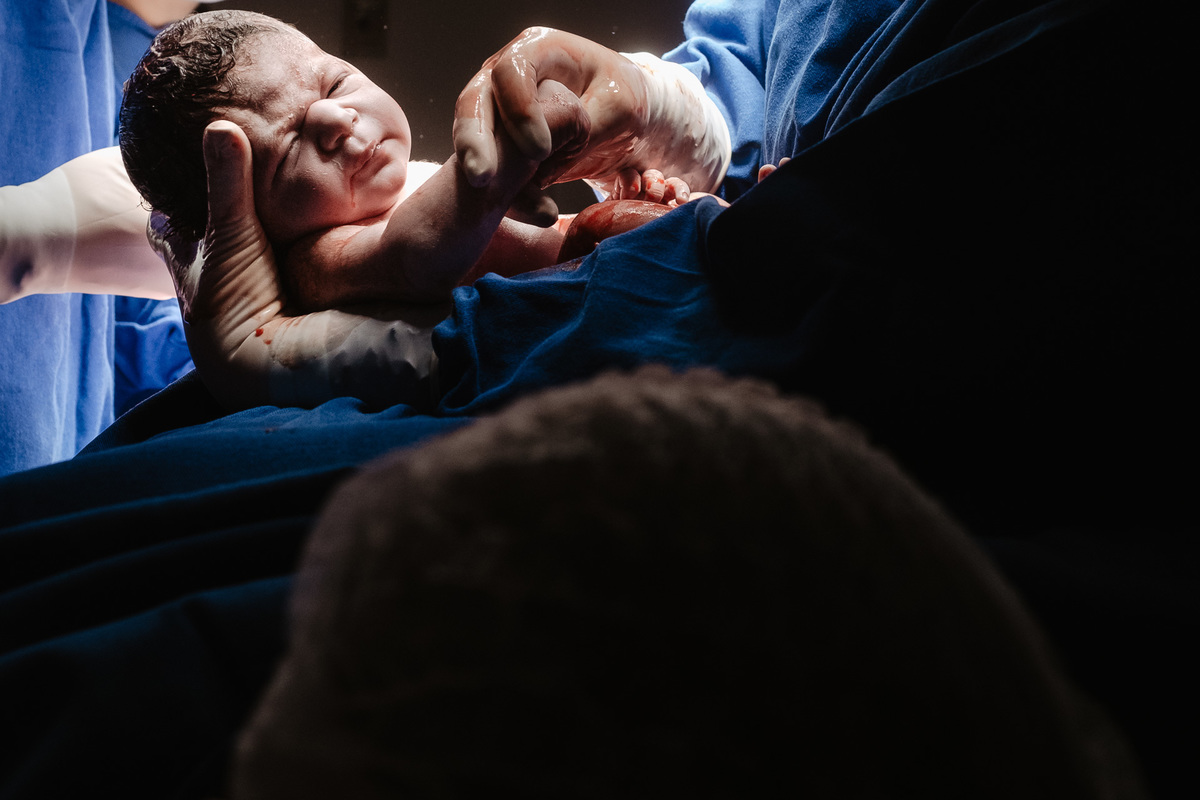 Cesárea humanizada registrada por Thiago Braga Fotografia na Maternidade Santa Helena em Florianópolis