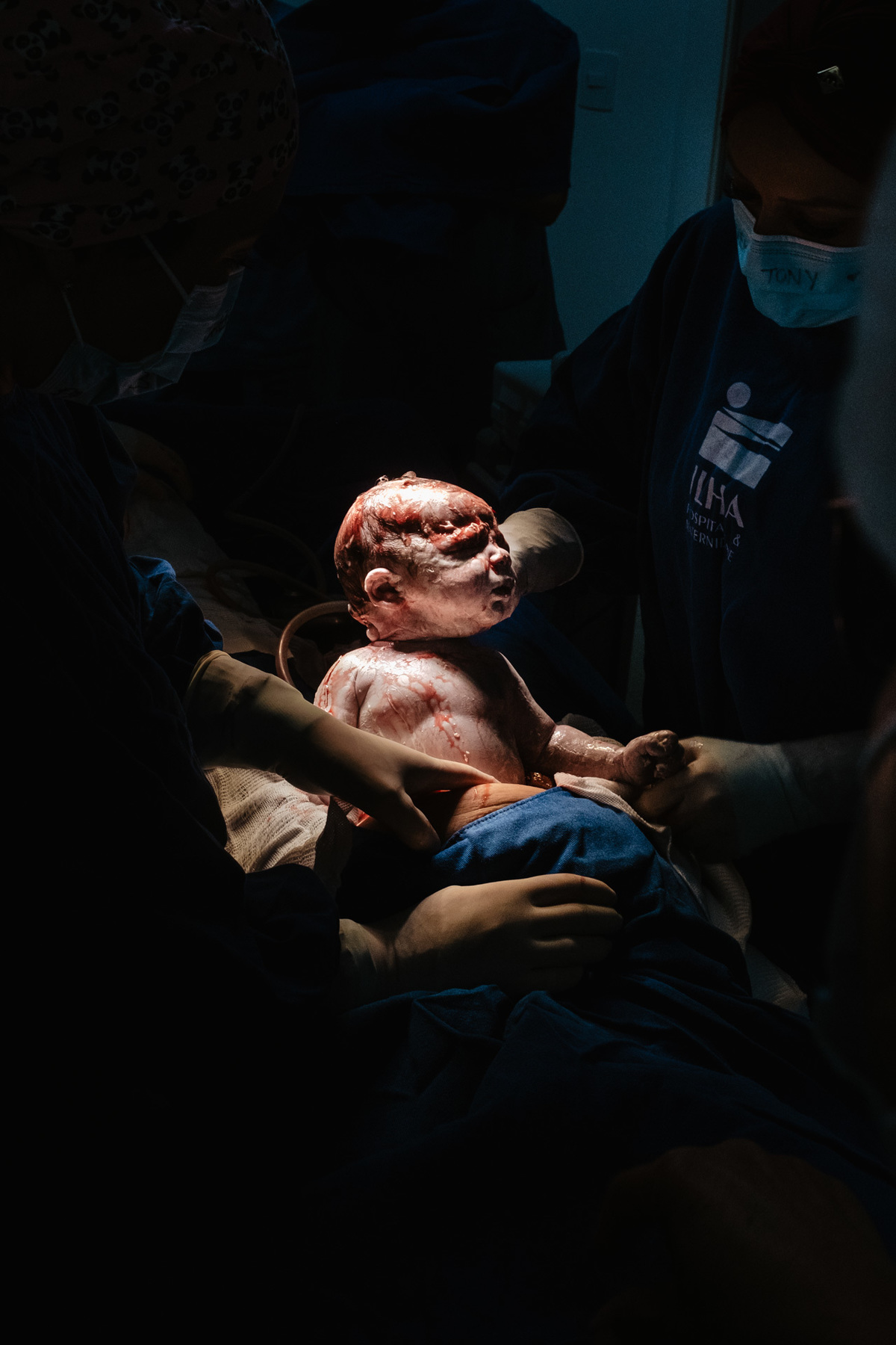 parto cesárea humanizado no ilha Hospital e maternidade por Thiago Braga Fotografia