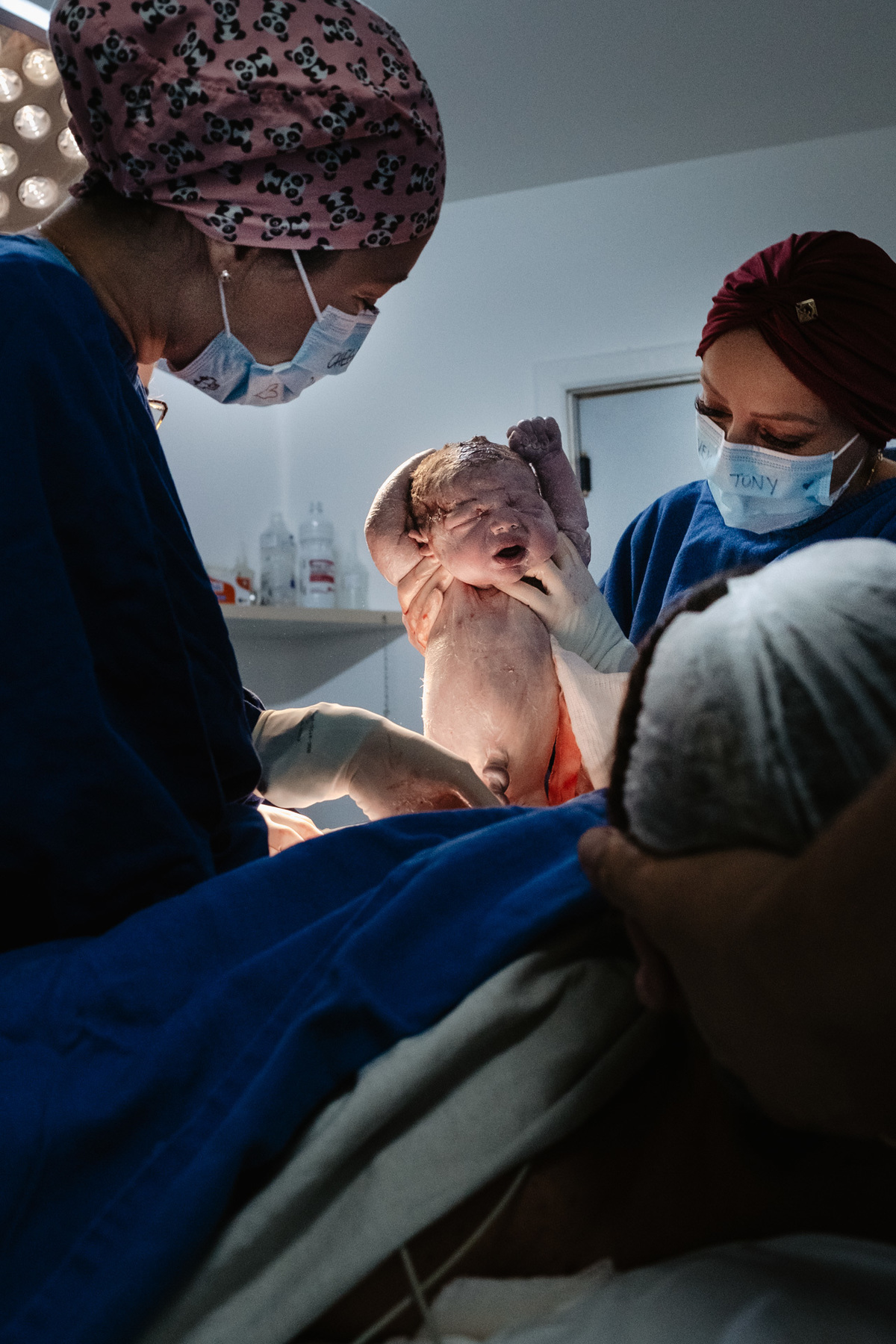 parto cesárea humanizado no ilha Hospital e maternidade por Thiago Braga Fotografia