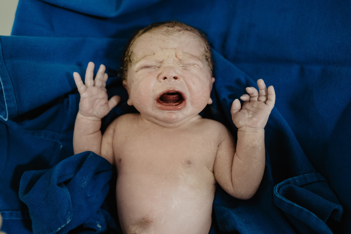 parto cesárea humanizado no ilha Hospital e maternidade por Thiago Braga Fotografia