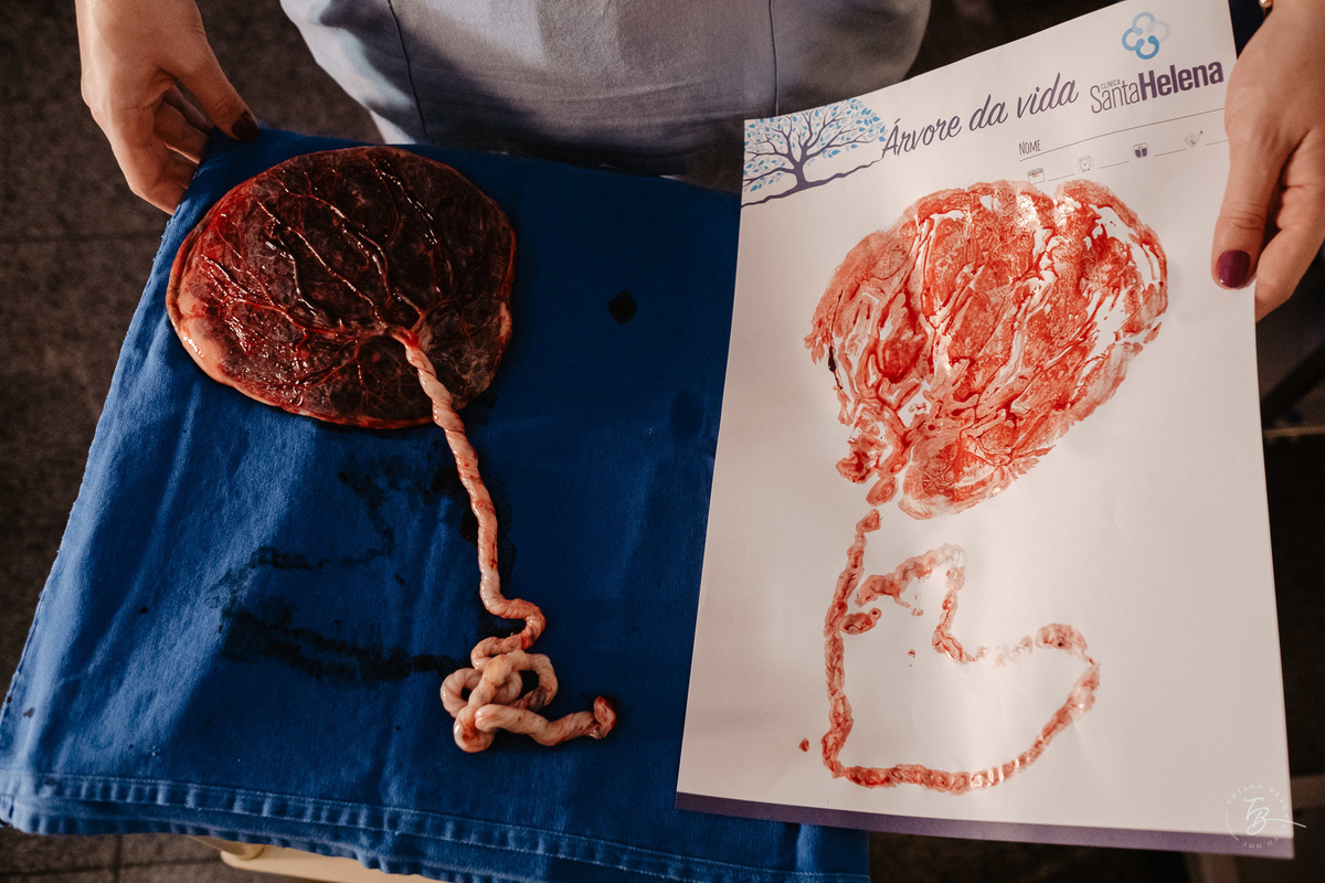 fotografia de parto normal na maternidade santa helena em florianópolis, fotos de parto por Thiago Braga fotografia