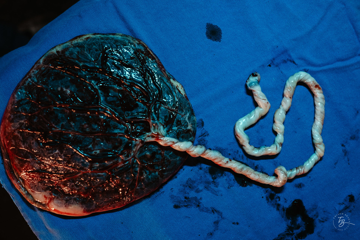 fotografia de parto normal na maternidade santa helena em florianópolis, fotos de parto por Thiago Braga fotografia