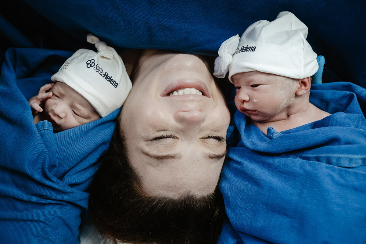parto gemelar, cesárea de gêmeos, fotos de nascimento na maternidade Santa Helena em Florianópolis/Sc por Thiago Braga