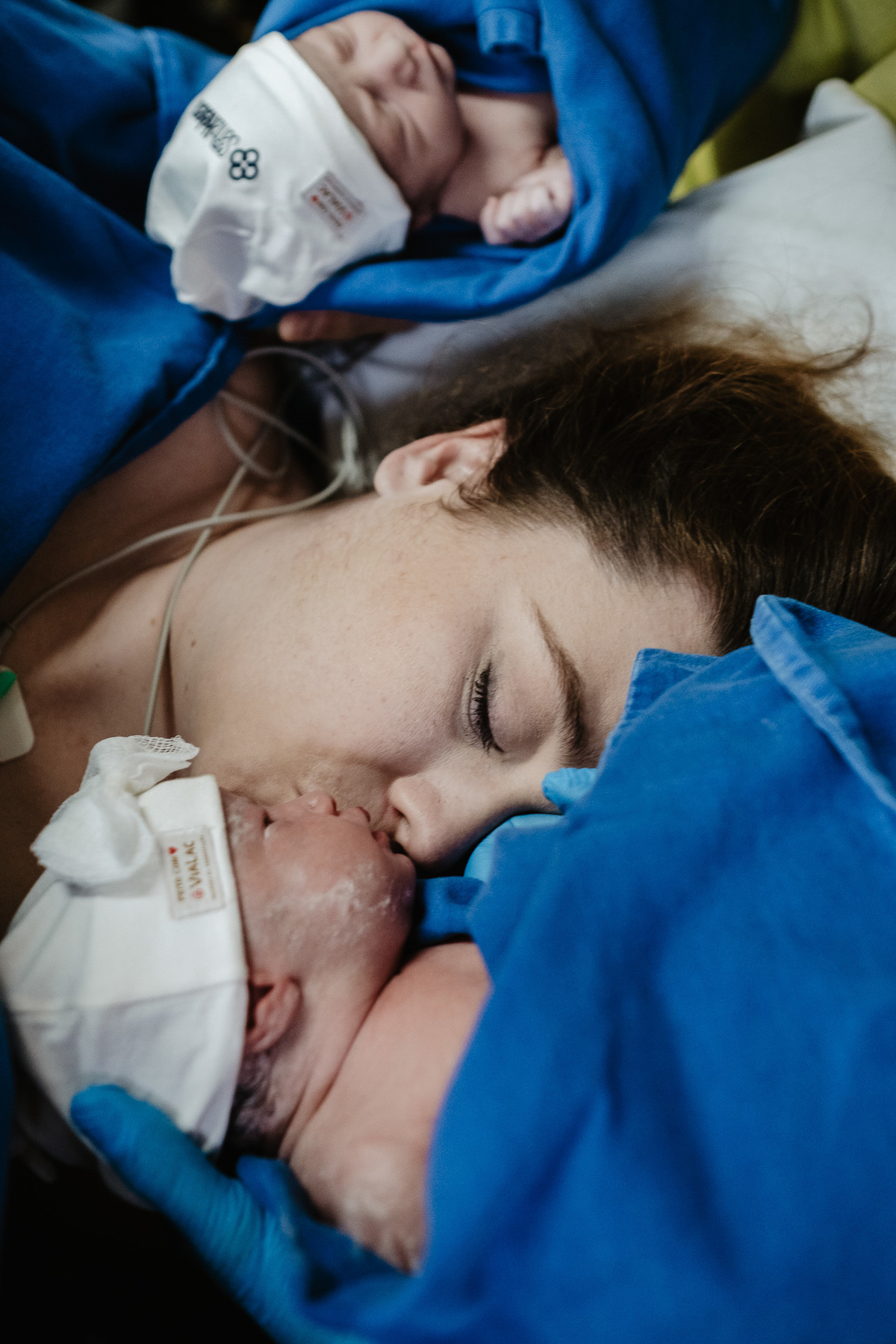 parto gemelar, cesárea de gêmeos, fotos de nascimento na maternidade Santa Helena em Florianópolis/Sc por Thiago Braga