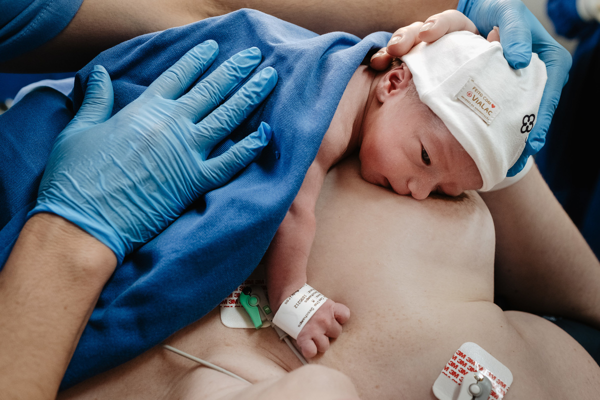 parto gemelar, cesárea de gêmeos, fotos de nascimento na maternidade Santa Helena em Florianópolis/Sc por Thiago Braga
