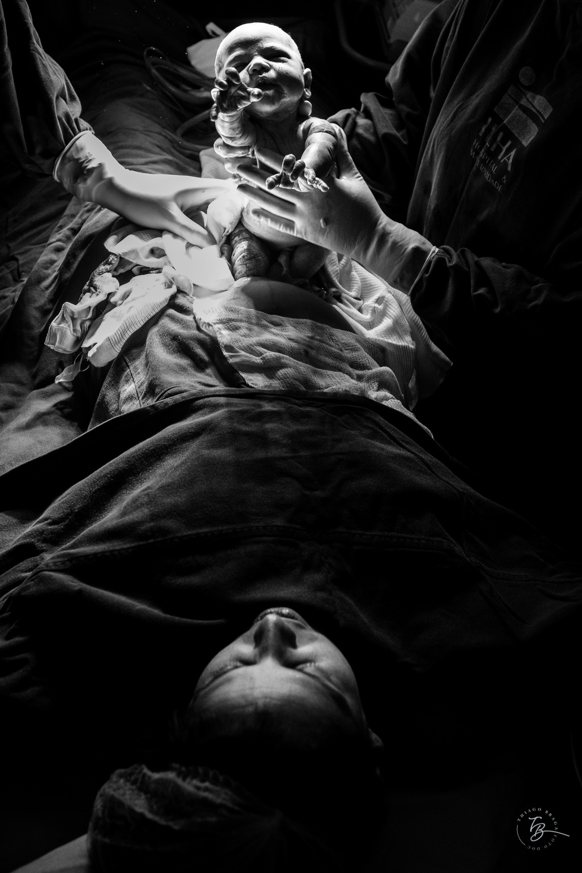 cesárea humanizada na maternidade ilha em Florianópolis por Thiago Braga