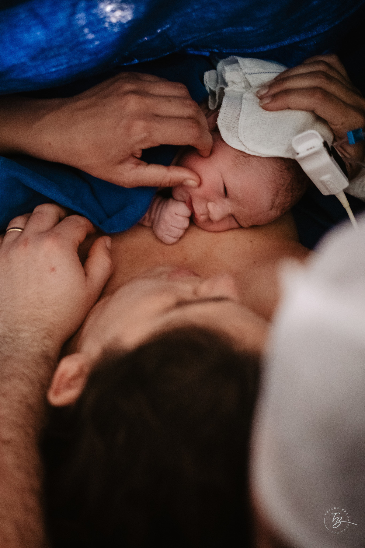 cesárea humanizada na maternidade ilha em Florianópolis por Thiago Braga