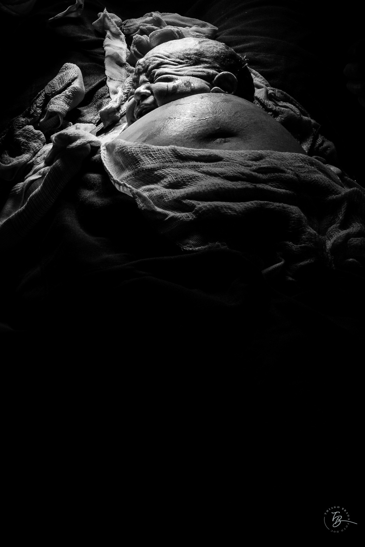 cesárea humanizada na maternidade ilha em Florianópolis por Thiago Braga