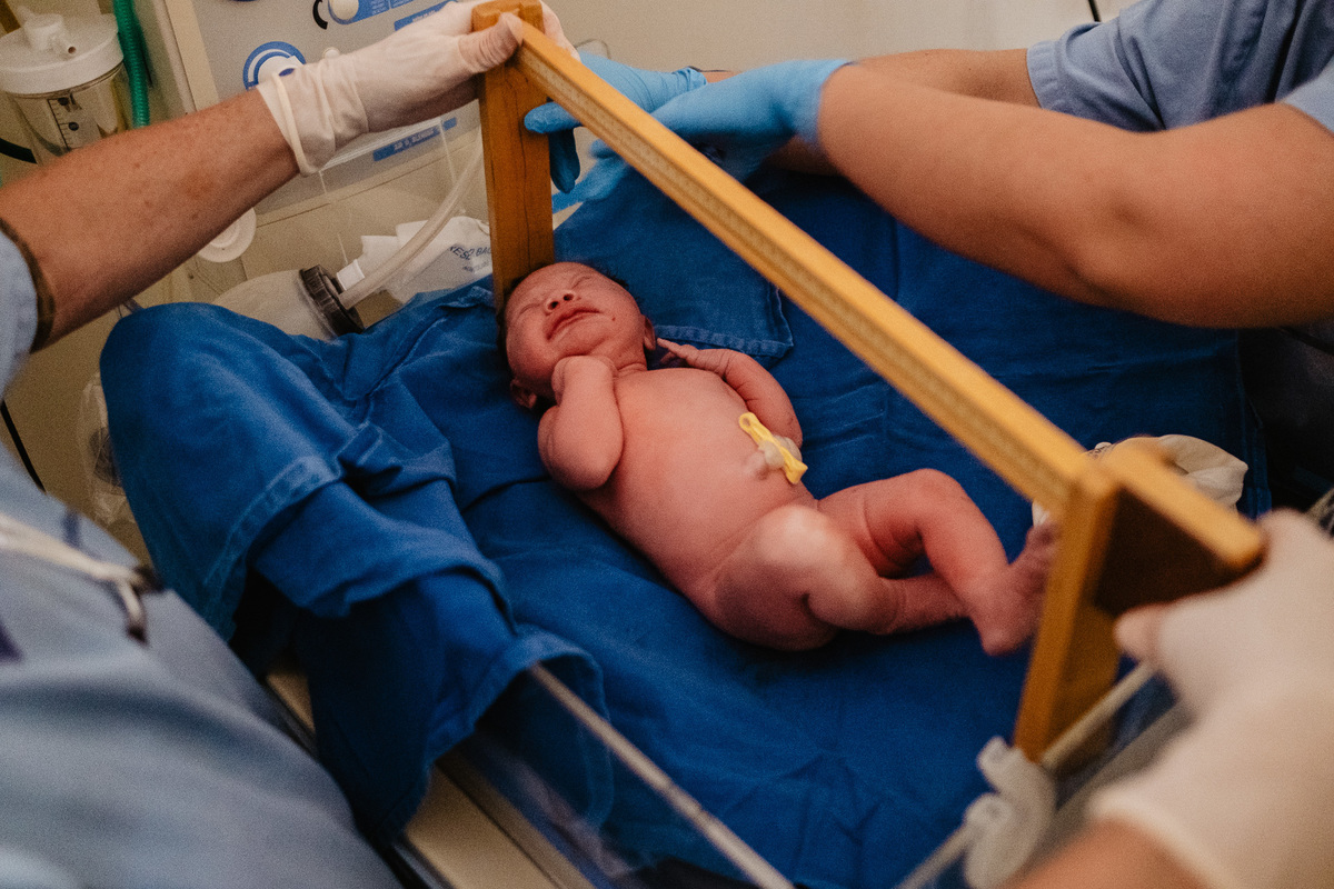 Trabalho de parto e nascimento. Fotografia na maternidade Santa Helen em Florianópolis pelo fotografo de parto Thiago Braga. 