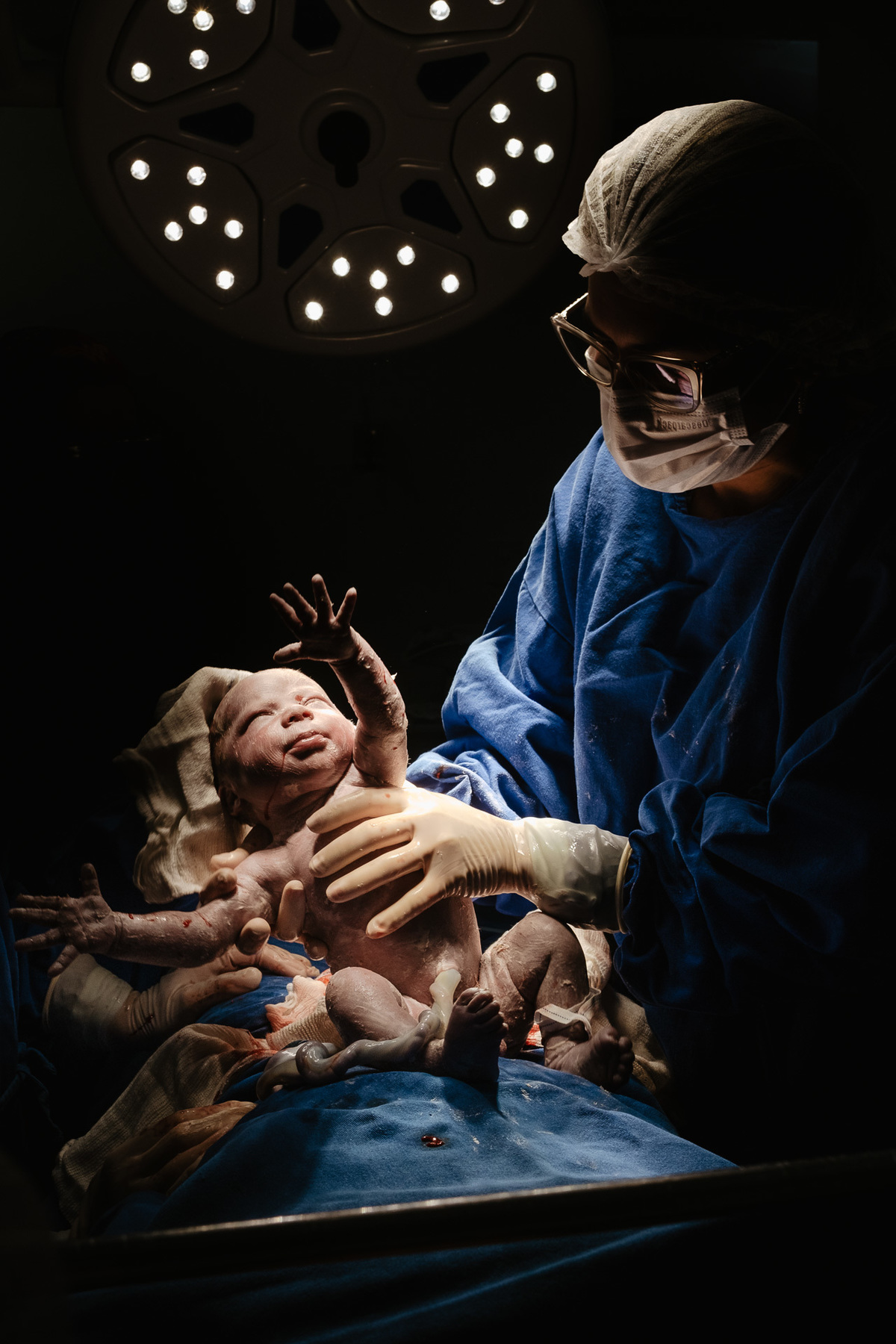 Cesárea humanizada. A chegada do Davi, nascimento em Florianópolis na Clínica Santa Helena. Por Thiago Braga Fotografia. 