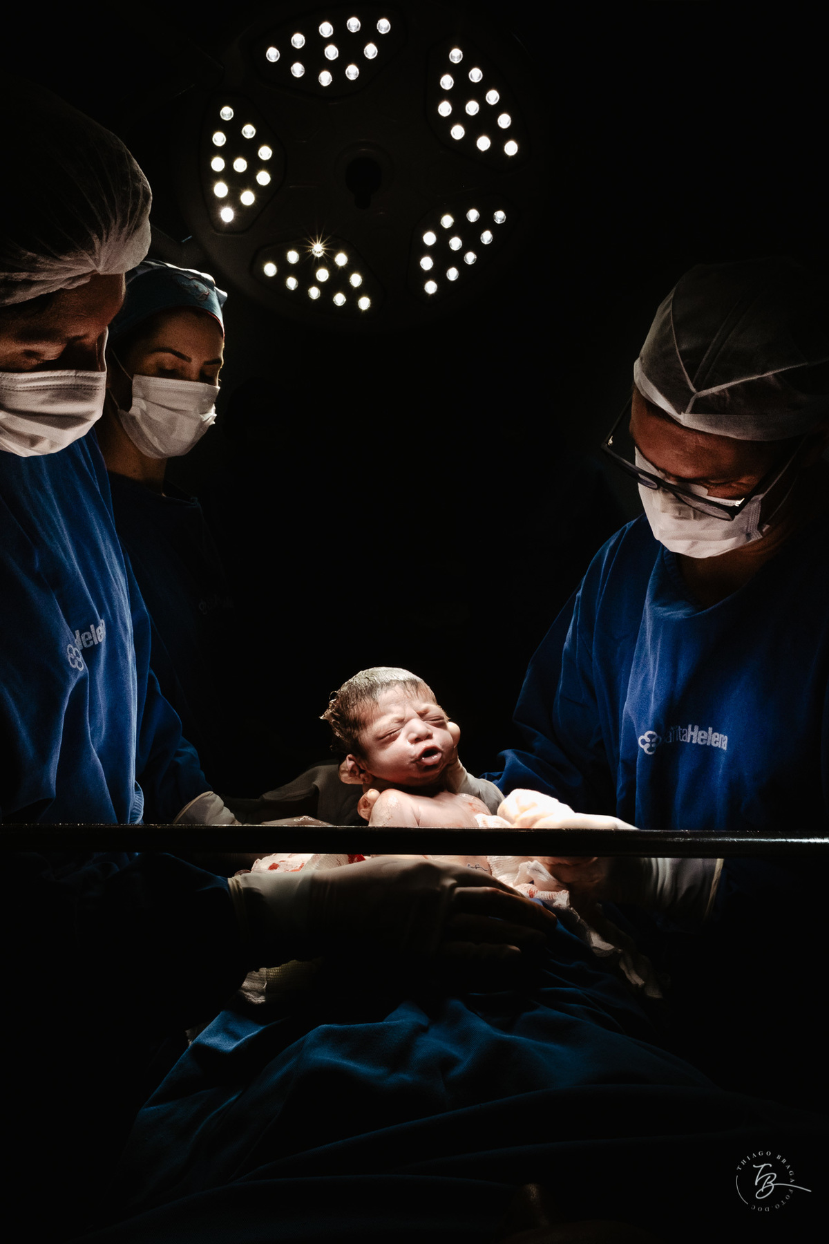 cesárea humanizada na maternidade Santa Helena em Florianópolis por Thiago Braga fotografia de parto