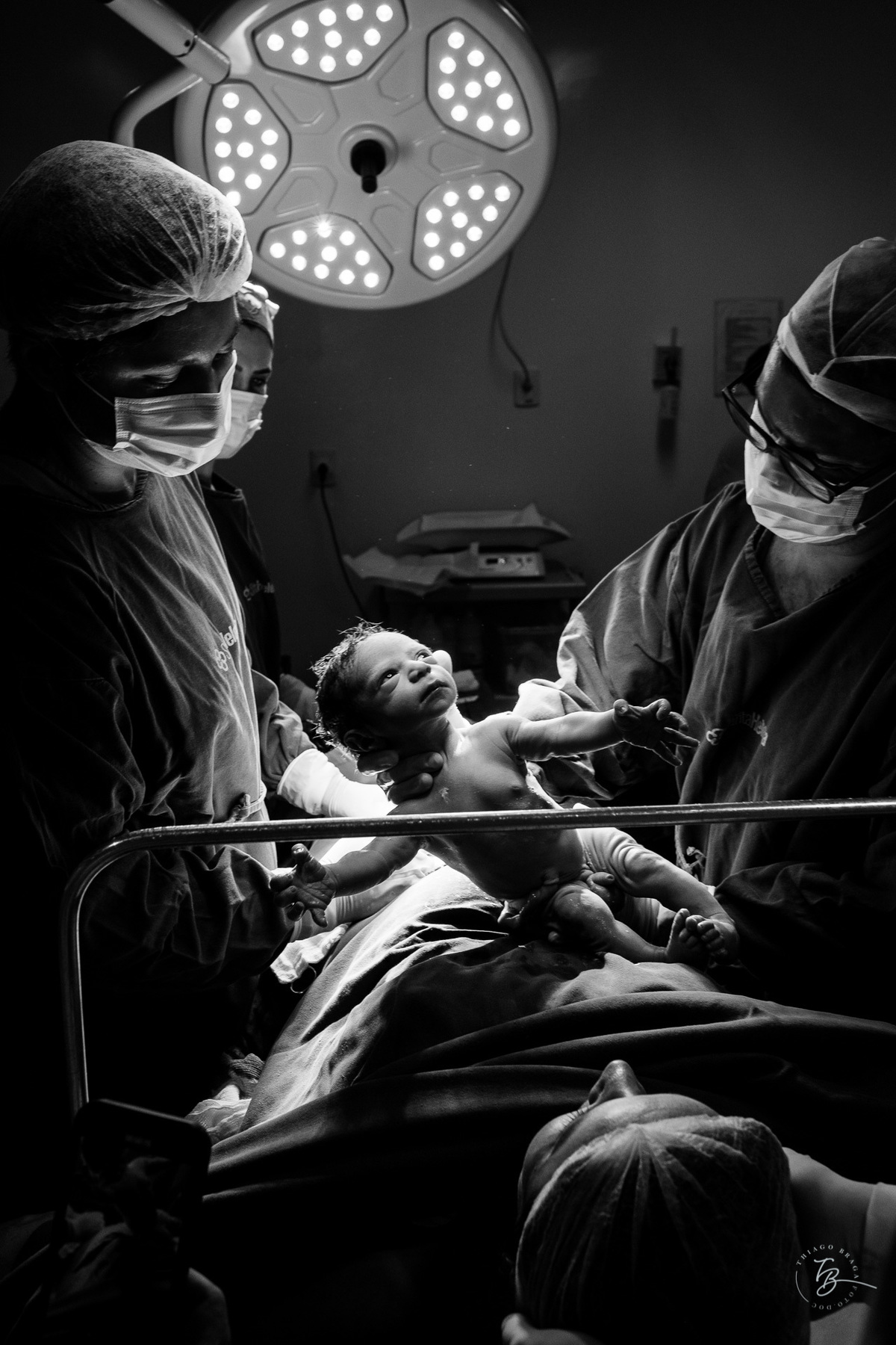 cesárea humanizada na maternidade Santa Helena em Florianópolis por Thiago Braga fotografia de parto