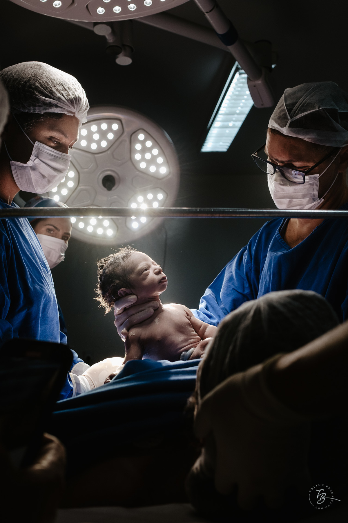 cesárea humanizada na maternidade Santa Helena em Florianópolis por Thiago Braga fotografia de parto