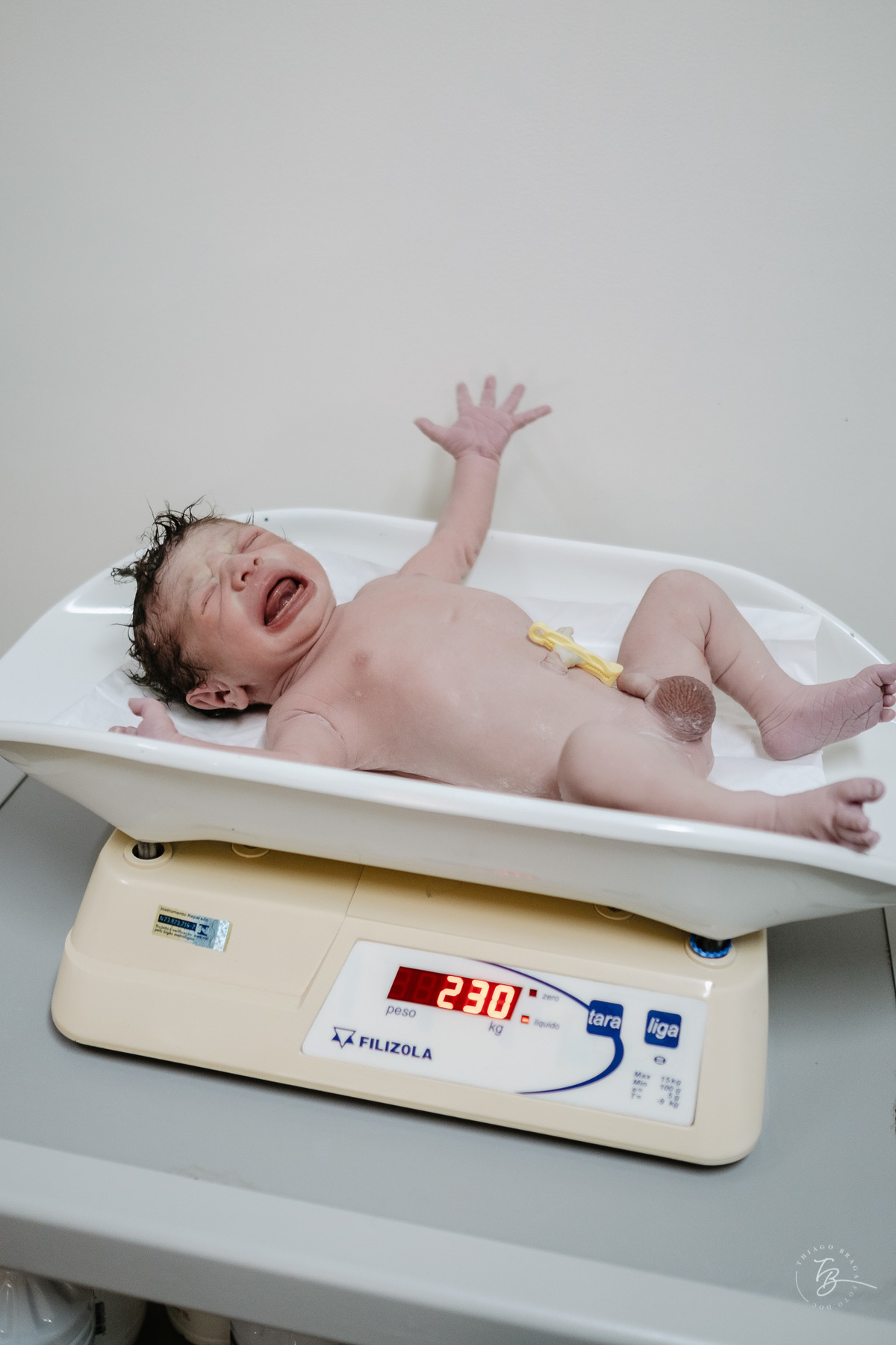 cesárea humanizada na maternidade Santa Helena em Florianópolis por Thiago Braga fotografia de parto