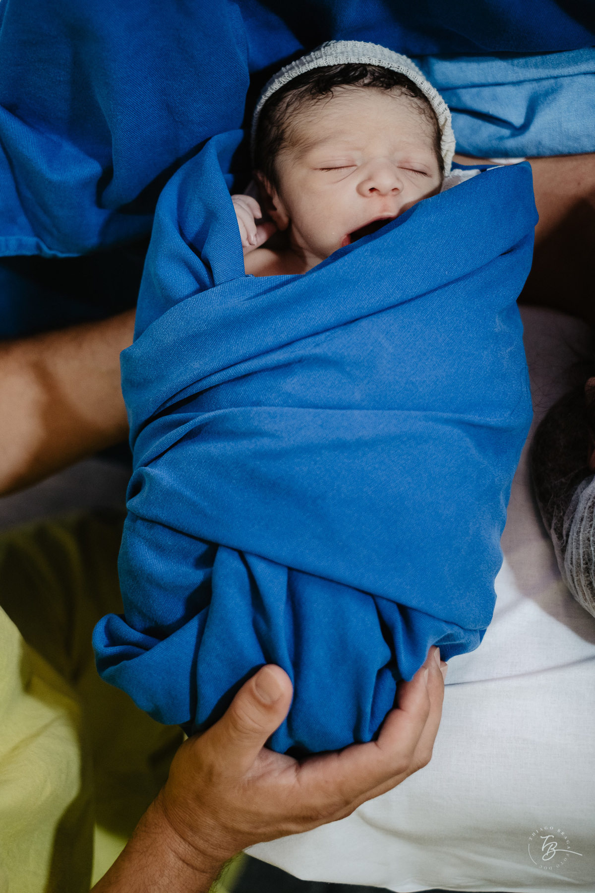 cesárea humanizada na maternidade Santa Helena em Florianópolis por Thiago Braga fotografia de parto