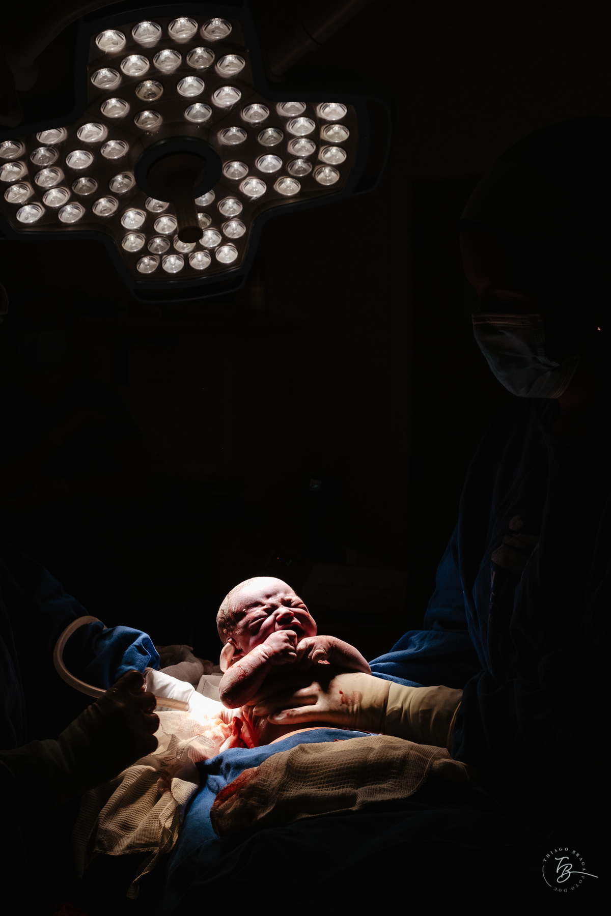Cesárea humanizada, nascimento da Amália, Maternidade Ilha em Florianópolis por Thiago Braga fotografia de parto