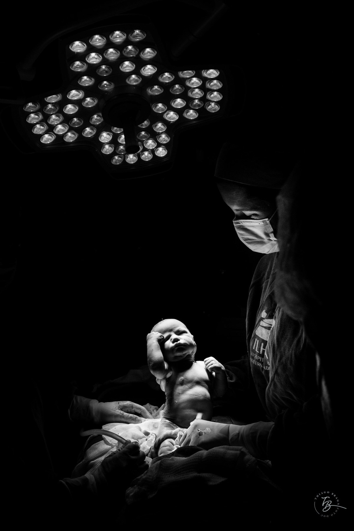 Cesárea humanizada, nascimento da Amália, Maternidade Ilha em Florianópolis por Thiago Braga fotografia de parto