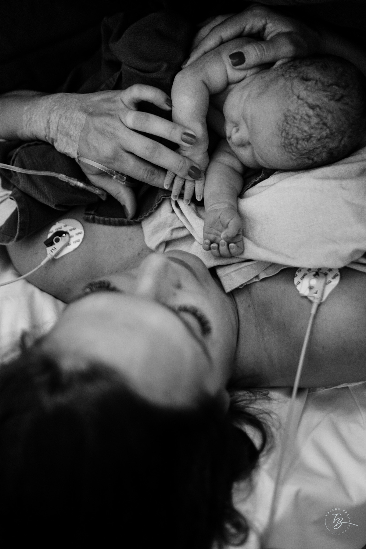 Cesárea humanizada, nascimento da Amália, Maternidade Ilha em Florianópolis por Thiago Braga fotografia de parto