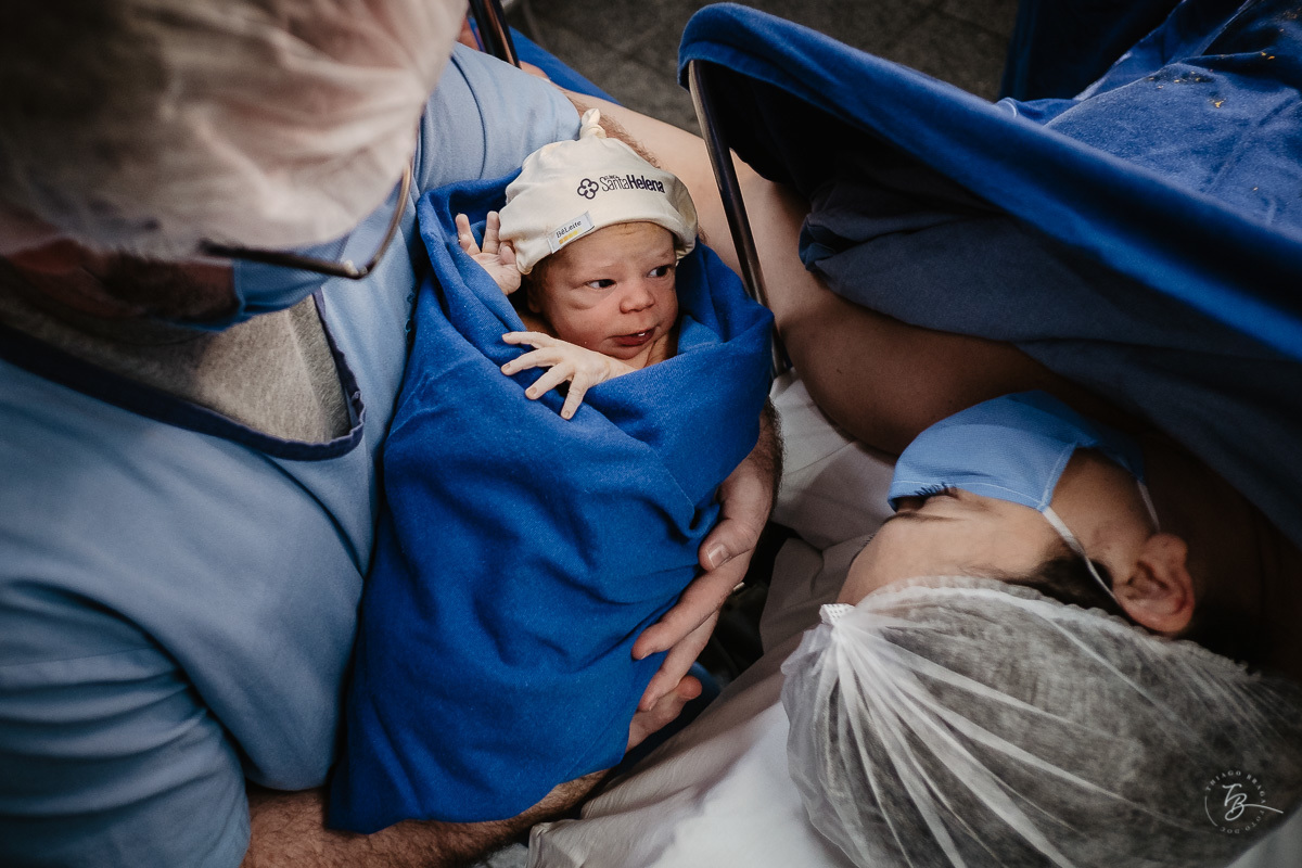 fotografia documental de parto, maternidade Santa Helena, Florianópolis. Chegada da Theodora. Parto Cesárea. Thiago Braga Fotografia. 